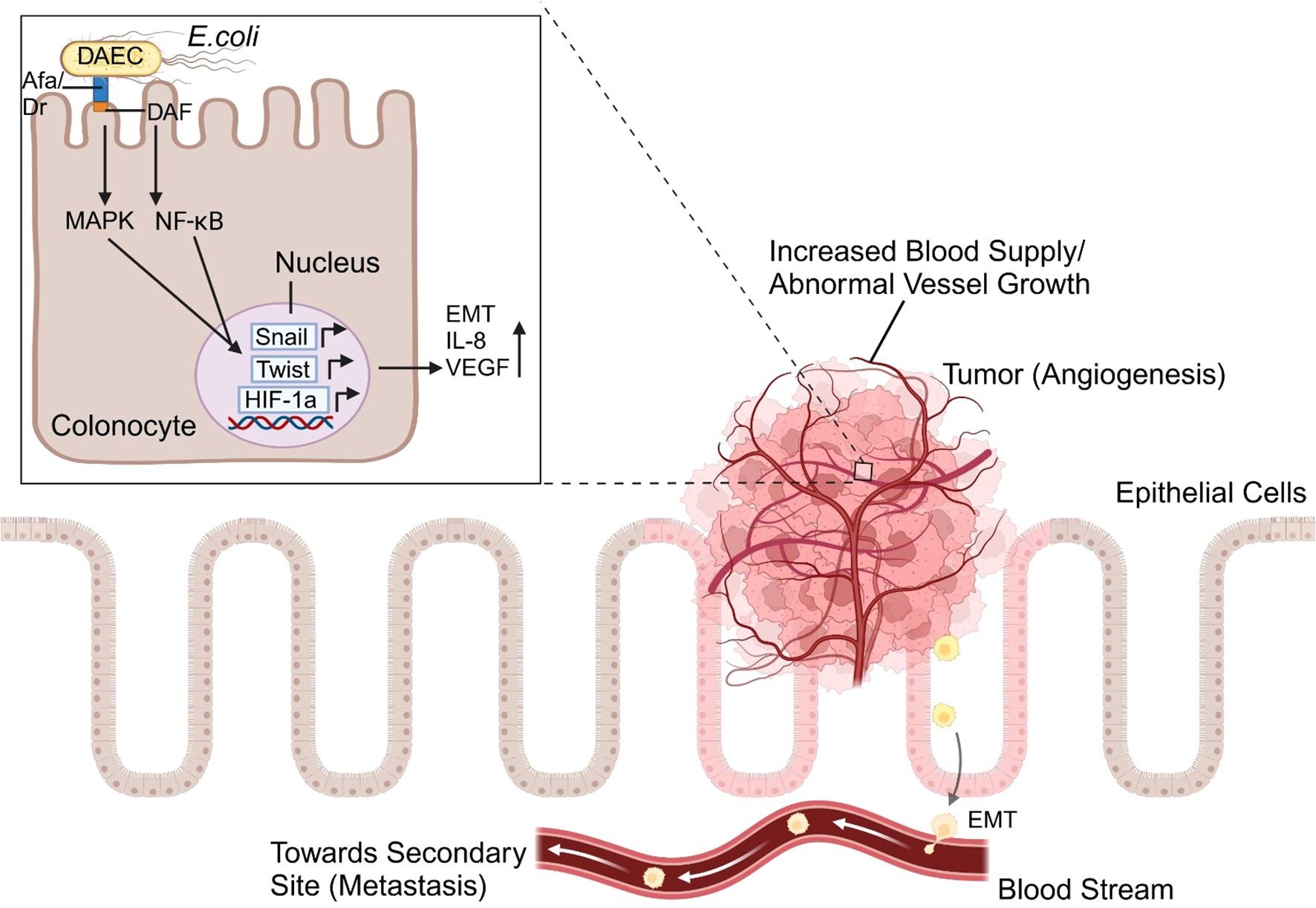Diagram illustrating E. coli interacting with colonocytes, triggering MAPK and NF-κB pathways, leading to gene expressions like Snail, Twist, and HIF-1a. This results in increased EMT, IL-8, and VEGF, promoting tumor angiogenesis and blood supply, facilitating metastasis.