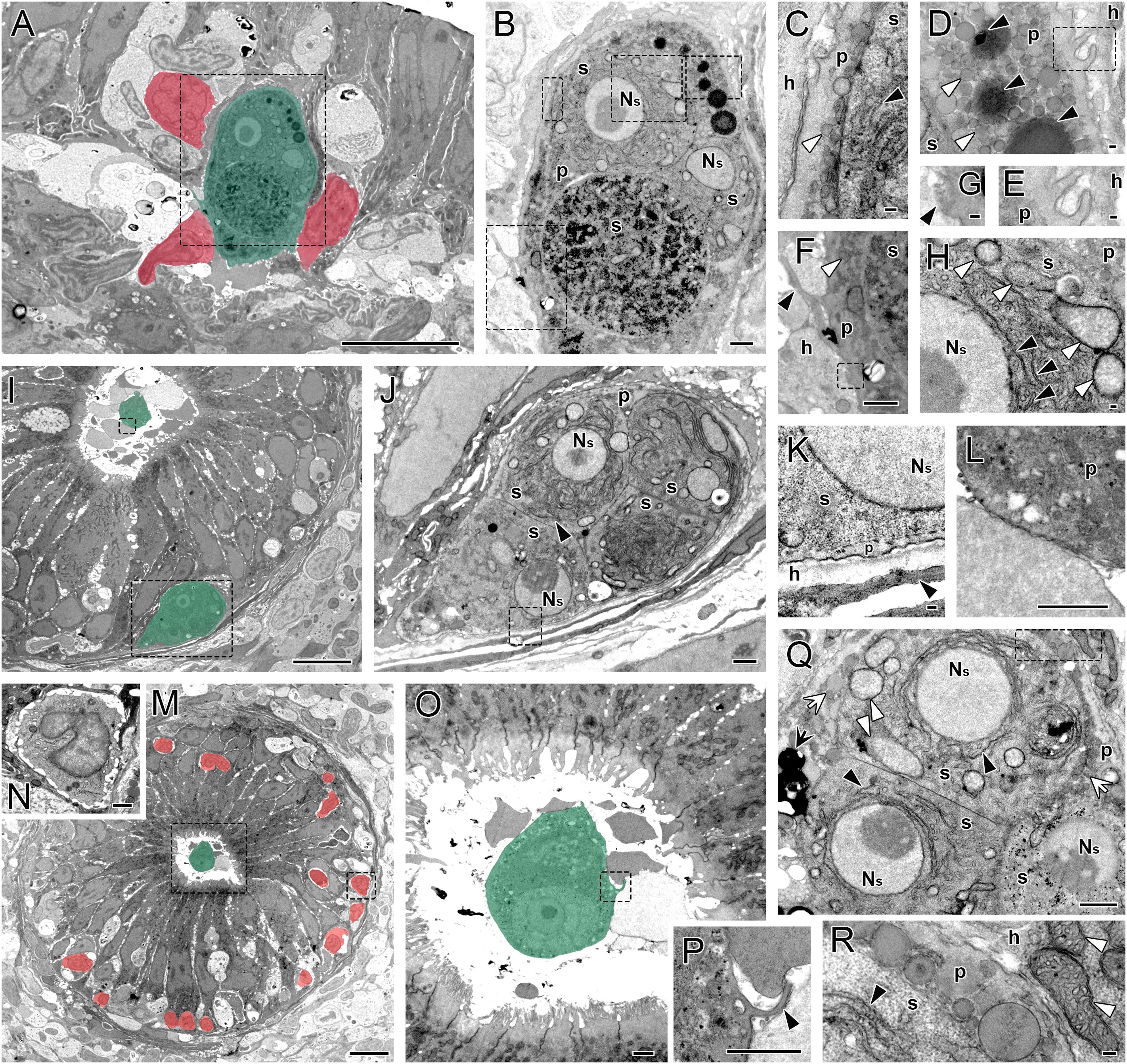 Microscopic images showing cellular structures with highlighted areas in green and red. Panels A, I, M, and O depict cells with green and red highlighting. Panels B, J, Q, and R show detailed views of cellular components, including nuclei and surrounding structures, labeled with various markers. Panels C, D, E, F, G, H, K, L, N, and P provide close-ups of specific cell regions, emphasizing subcellular features like the nucleus and surrounding organelles. Each panel is labeled for reference.