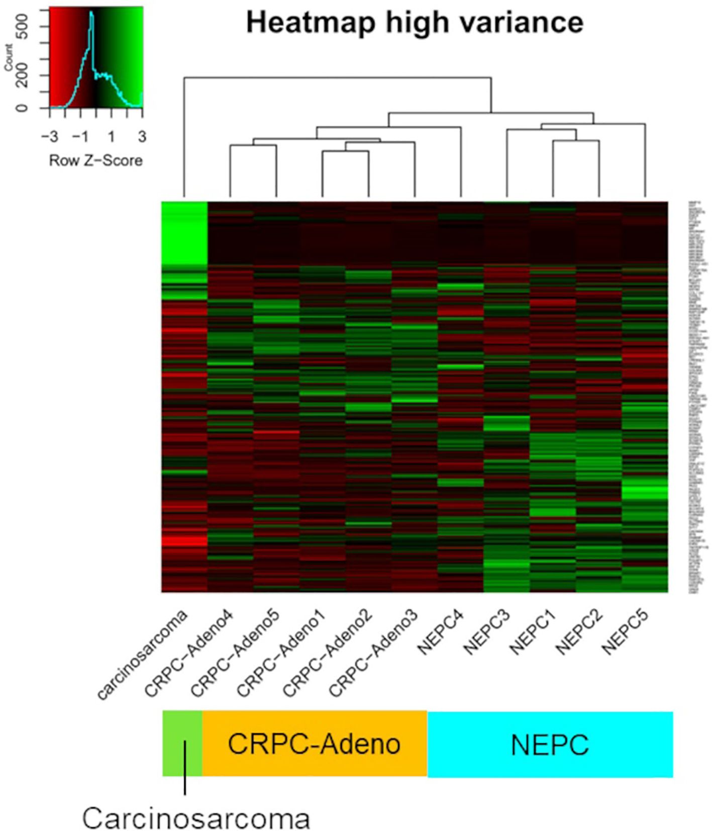 Heatmap titled “Heatmap high variance” displaying gene expression data with a color scale from red to green indicating row Z-scores. Rows represent genes and columns represent samples including carcinomas, CRPC-Asenos, and NEPCs. A dendrogram above clusters the samples. The top left corner shows a color scale histogram, and colored boxes at the bottom label sample groups: CRPC-Adeno (yellow) and NEPC (blue).