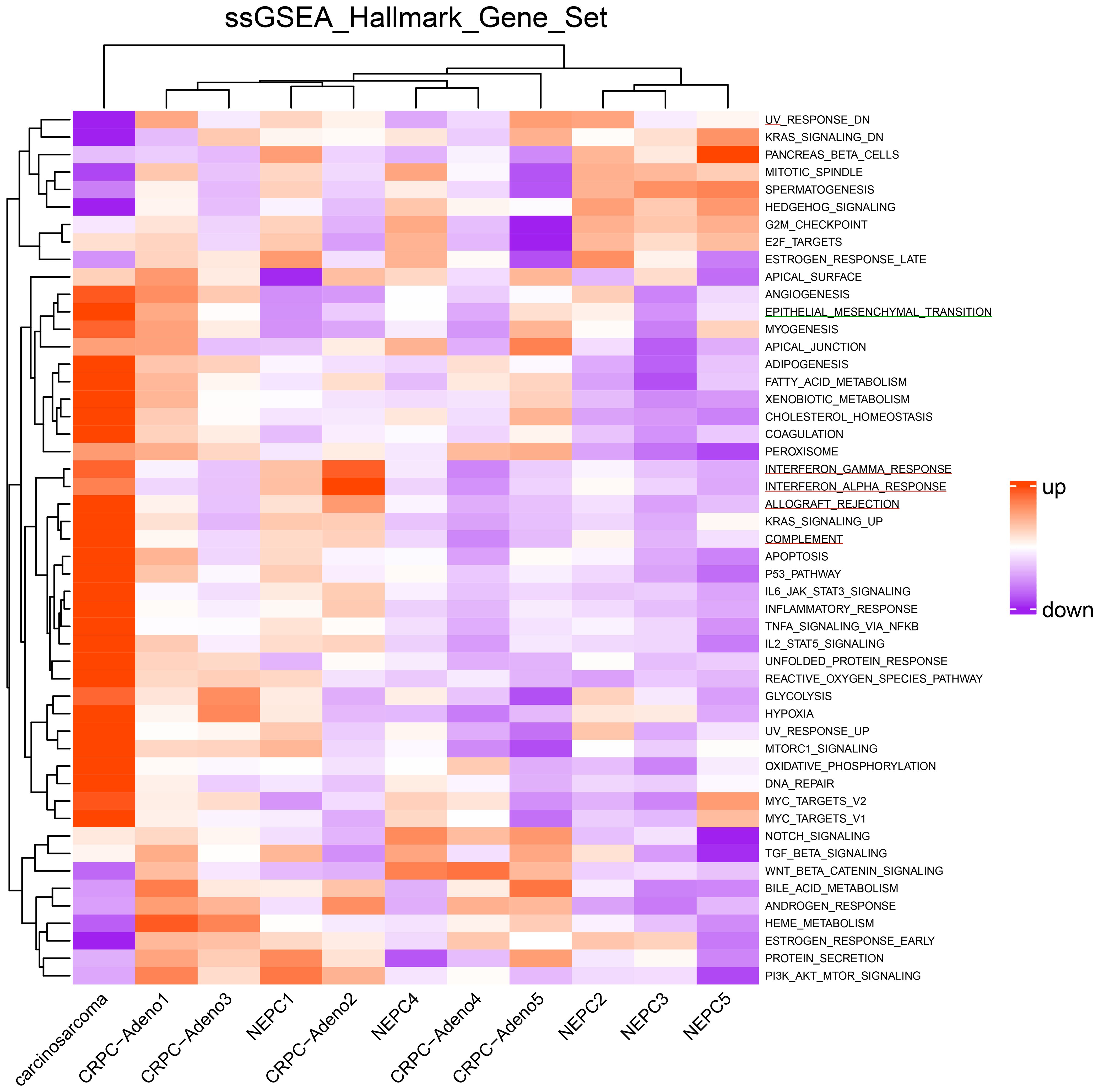 Heatmap titled “ssGSEA_Hallmark_Gene_Set” showing gene expression levels across different samples. Rows represent gene sets, and columns represent sample types like carcinosarcoma and NEPC subtypes. Colors range from red (upregulation) to purple (downregulation). Gene sets include “INTERFERON_GAMMA_RESPONSE” and “KRAS_SIGNALING_UP”.
