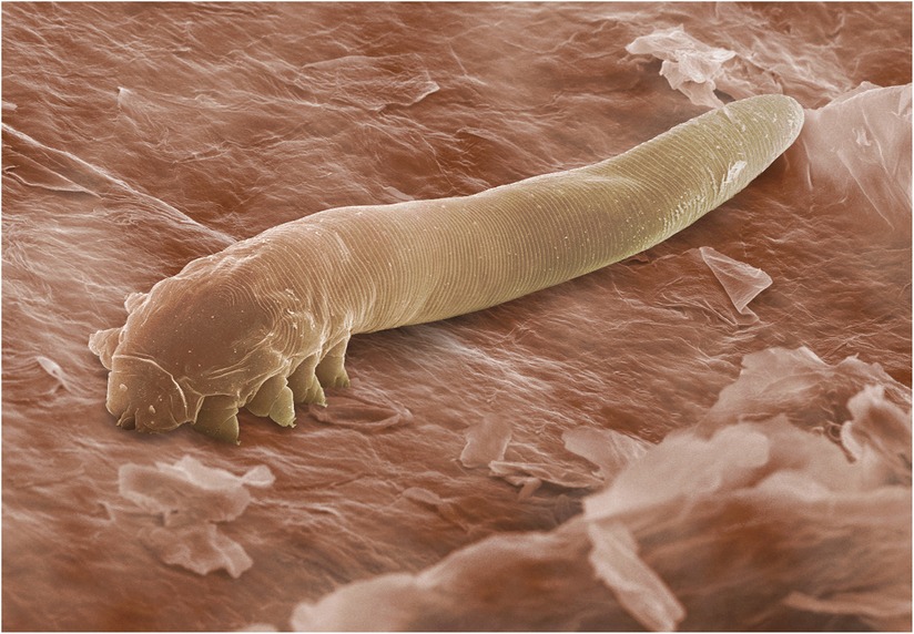 Colourised scanning electron microscope image of a Demodex folliculorum mite with eight short, sturdy legs, hooked claws and a long, finger-shaped, ribbed abdomen.