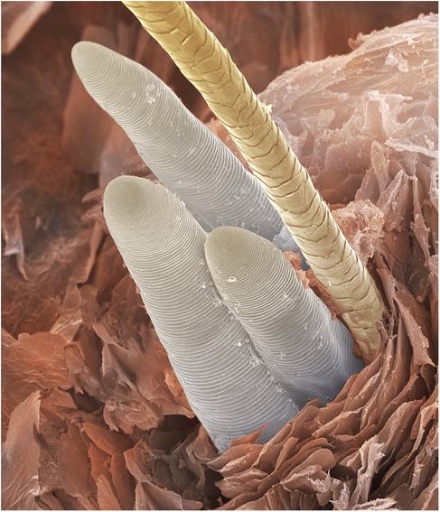 Electron microscope image of a hair follicle, showing the hair shaft surrounded by three Demodex folliculorum, visible only by their elongated abdomens protruding from the follicle.
