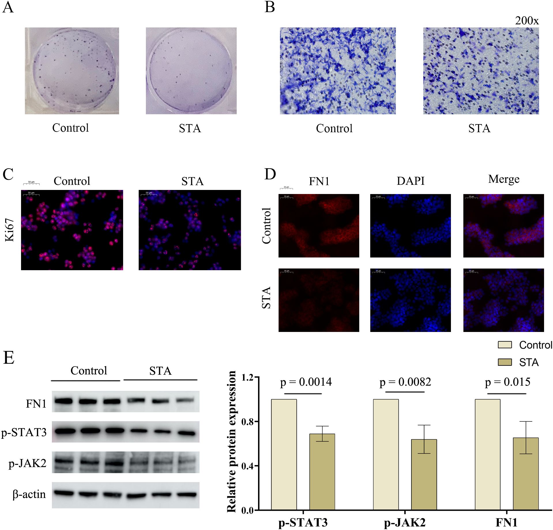 A composite image with five panels labeled A to E. Panel A shows two petri dishes with colonies, labeled Control and STA. Panel B displays two cell images at 200x magnification, showing more cell density in the Control than STA. Panel C presents two side-by-side immunofluorescence images labeled Ki67, indicating more cell proliferation in Control versus STA. Panel D contains two rows of images labeled FN1, DAPI, and Merge for Control and STA, showing differences in protein expression. Panel E illustrates Western blot results comparing protein expression in Control and STA, with a bar graph showing significant differences in p-STAT3, p-JAK2, and FN1 expression levels.