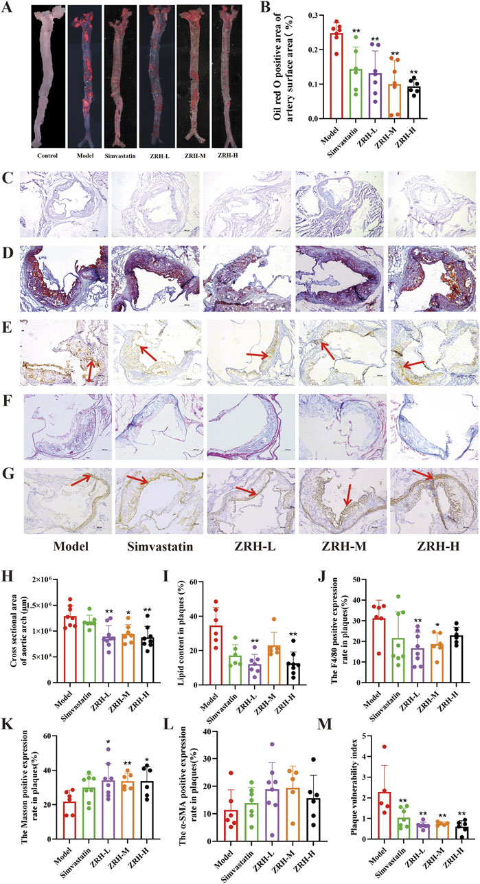 A series of images and charts: Panel A shows arteries under different treatments. Panel B presents a bar graph of Oil Red O staining percentages. Panels C-G display microscopic artery cross-sections with various stains and arrows indicating points of interest. Panels H-M feature bar graphs comparing outcomes like lipid content and plaque vulnerability across treatments.