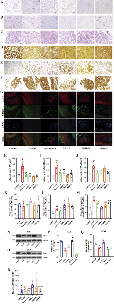 The image is a composite of various scientific panels showing microscopy images, fluorescence staining, and bar graphs related to adipose tissue research. Panels A to G depict different tissue treatments with magnified views. Panels H to R display bar graphs representing data analyses, such as adipocyte size, expression rates, and protein levels in different conditions, including control, model, simvastatin, and varying doses of ZRH. The charts illustrate comparative results across these conditions with markers for statistical significance.
