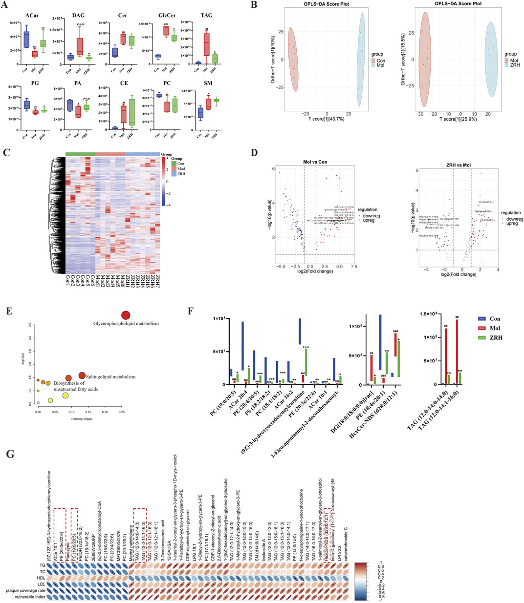 Composite image includes: A) Box plots showing lipid metabolite levels; B) OPLS-DA score plots illustrating group separation; C) Heatmap of lipid expression across samples; D) Volcano plots displaying differential expression analysis; E) Bubble plot of pathway impact, highlighting glycerophospholipid metabolism; F) Bar charts comparing metabolite concentrations in different groups; G) Heatmap of lipid-related markers and plaque coverage, indicating risk levels.