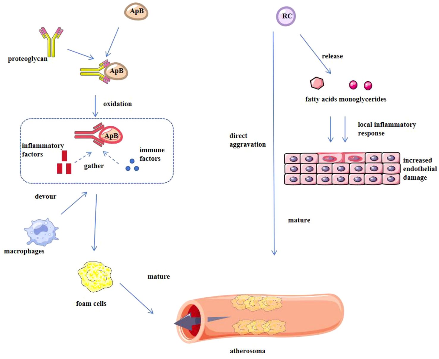 Diagram illustrating the formation of atherosomas. Apolipoprotein B (ApB) interacts with proteoglycans, undergoes oxidation, and gathers inflammatory and immune factors. Macrophages devour the oxidized ApB, becoming foam cells, which mature into atherosomas. Separately, release of fatty acids and monoglycerides from RC causes local inflammatory responses, leading to endothelial damage which contributes to atherosomas.