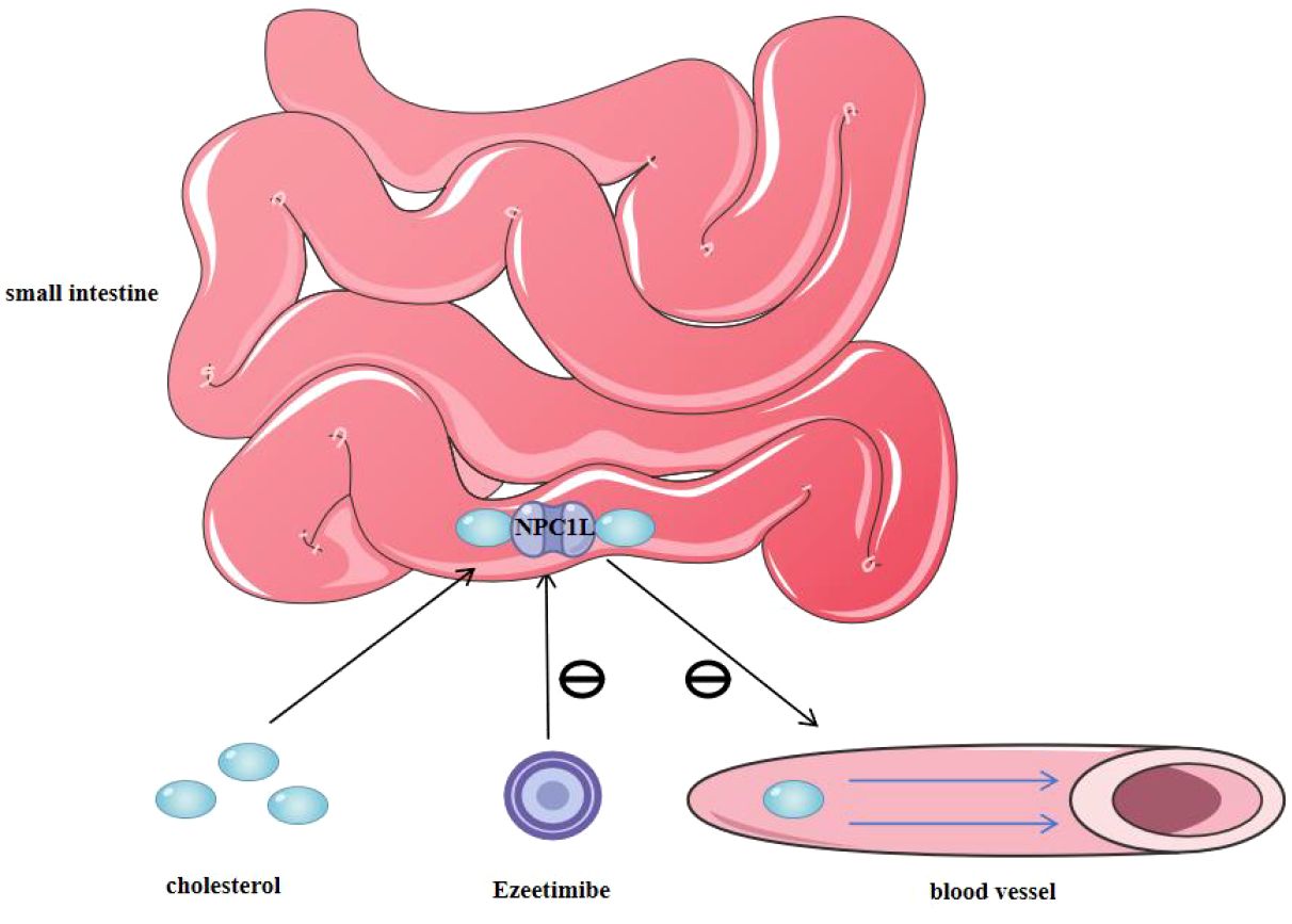 Diagram showing cholesterol absorption in the small intestine, with NPC1L1 protein facilitating transport into cells. Ezetimibe blocks this process. Cholesterol enters a blood vessel. Arrows indicate movement paths.