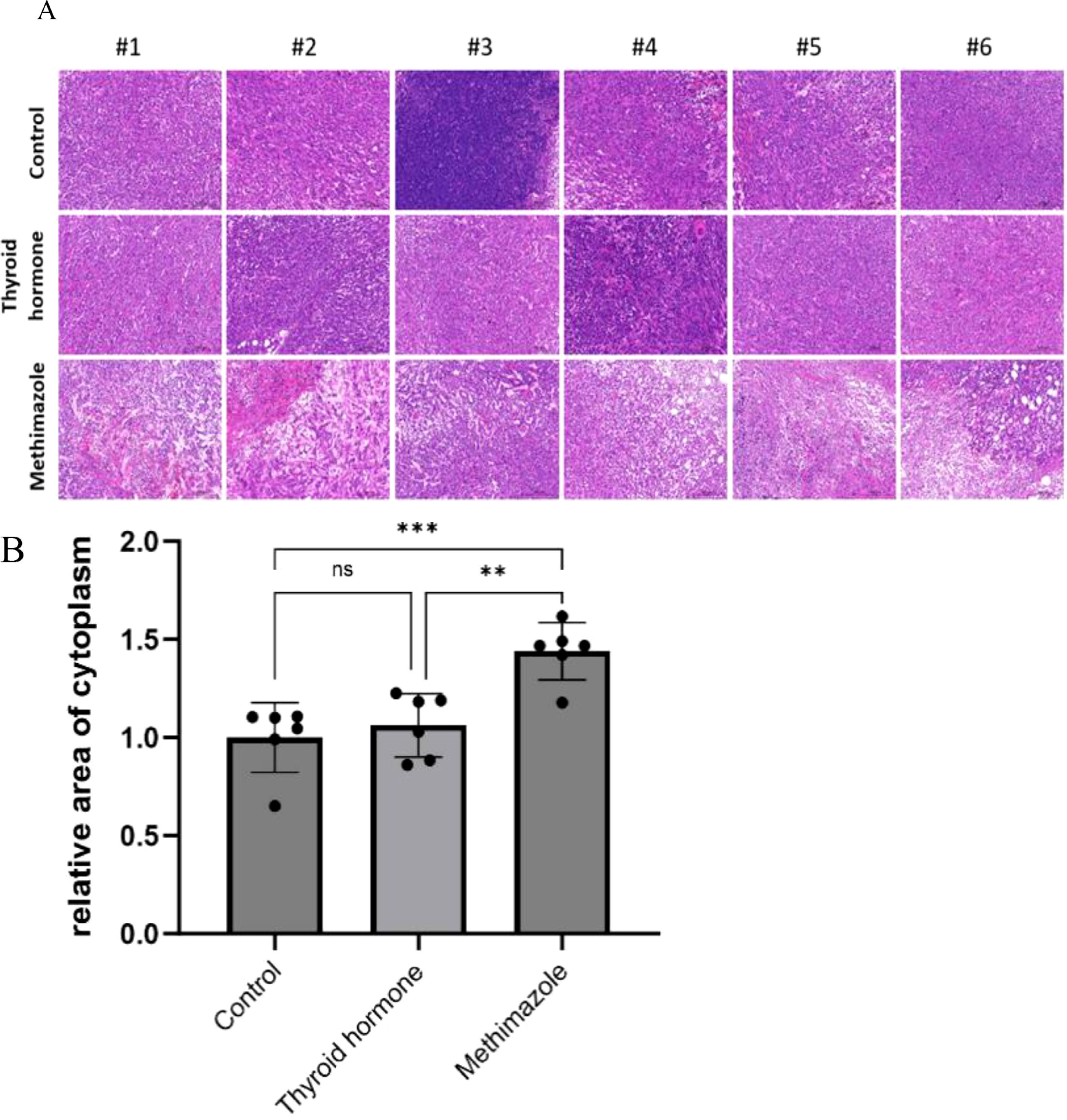 Panel A shows histological images of tissue sections under different conditions: Control, Thyroid hormone, and Methimazole, in six samples each. Panel B is a bar chart comparing the relative area of cytoplasm for Control, Thyroid hormone, and Methimazole groups, indicating significant increases in the Methimazole group. Statistical significance is marked by stars.