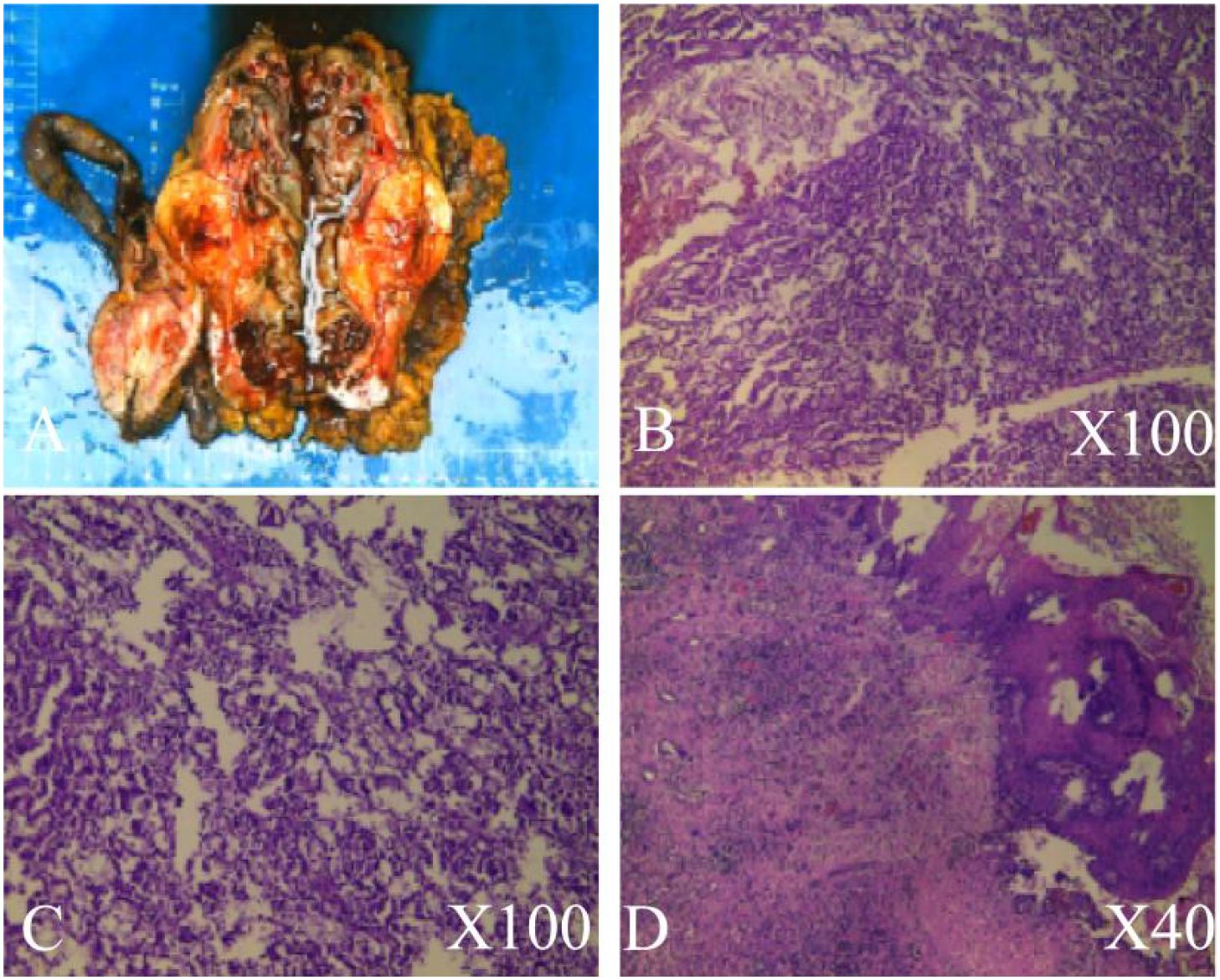 Panel A shows a sliced organ with visible internal structures on a blue background. Panels B and C display microscopic images of tissue at 100x magnification, highlighting dense cellular morphology. Panel D shows another tissue section at 40x magnification, revealing a different tissue structure.