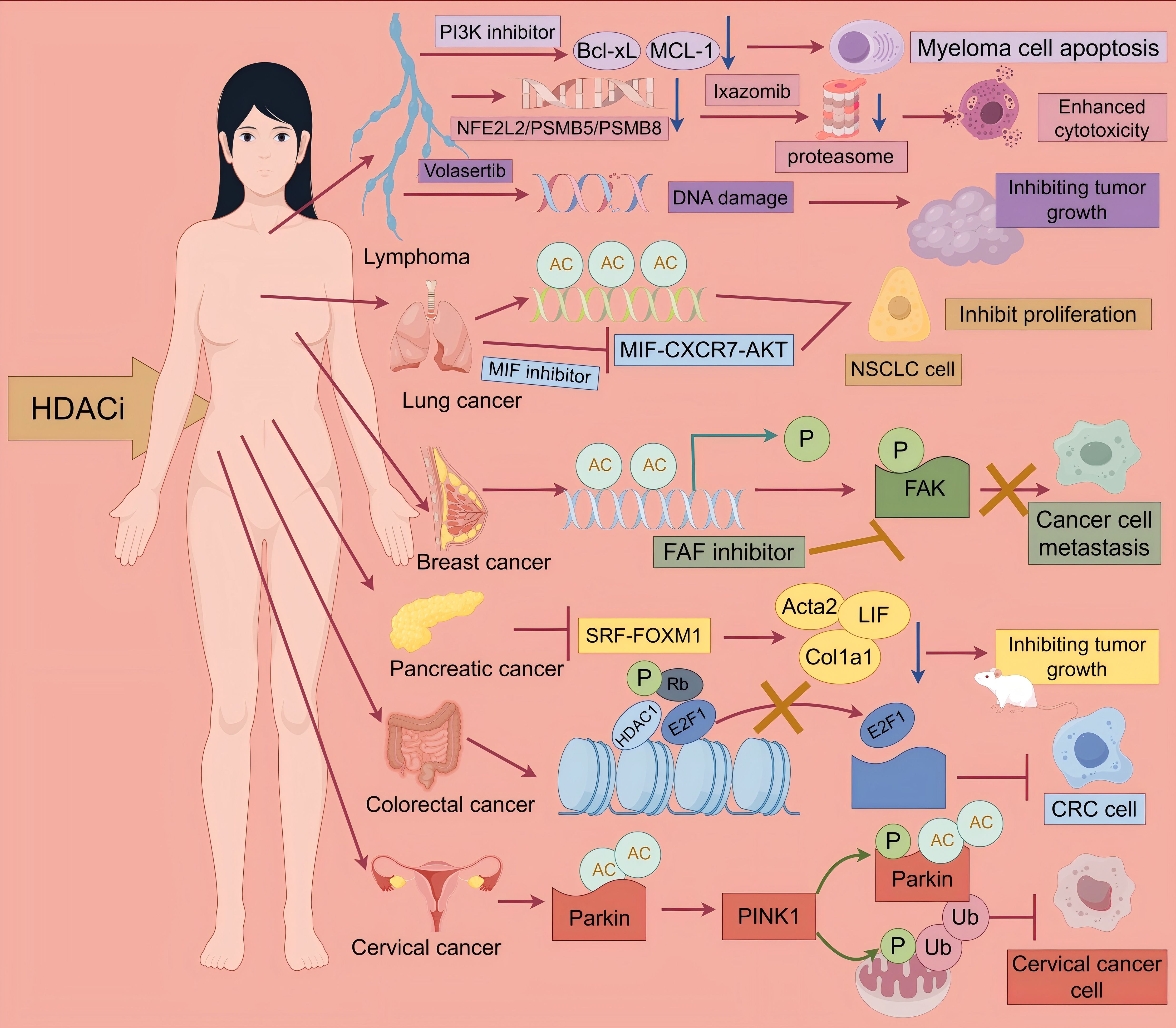Diagram showing inhibition of cancer pathways in a female body illustration. Different cancer types, such as lymphoma, lung, breast, pancreatic, colorectal, and cervical cancers, are linked with inhibitors like HDACi, PI3K, MIF, and FAF. Cellular processes like DNA damage, proteasome functions, and proteins like Parkin, PINK1, and others are depicted, showing pathways for apoptosis, proliferation inhibition, and metastasis prevention. Each cancer type is associated with specific pathways and molecular interactions.