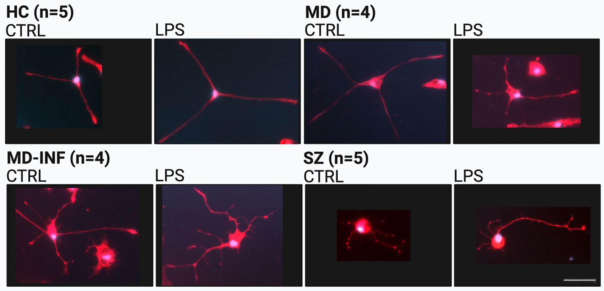 Fluorescent microscopy images show neuronal cells, stained red, in different conditions. Four panels compare control (CTRL) and lipopolysaccharide (LPS) treatments across different cohorts: HC, MD, MD-INF, and SZ. Each pair highlights changes in neuron morphology.