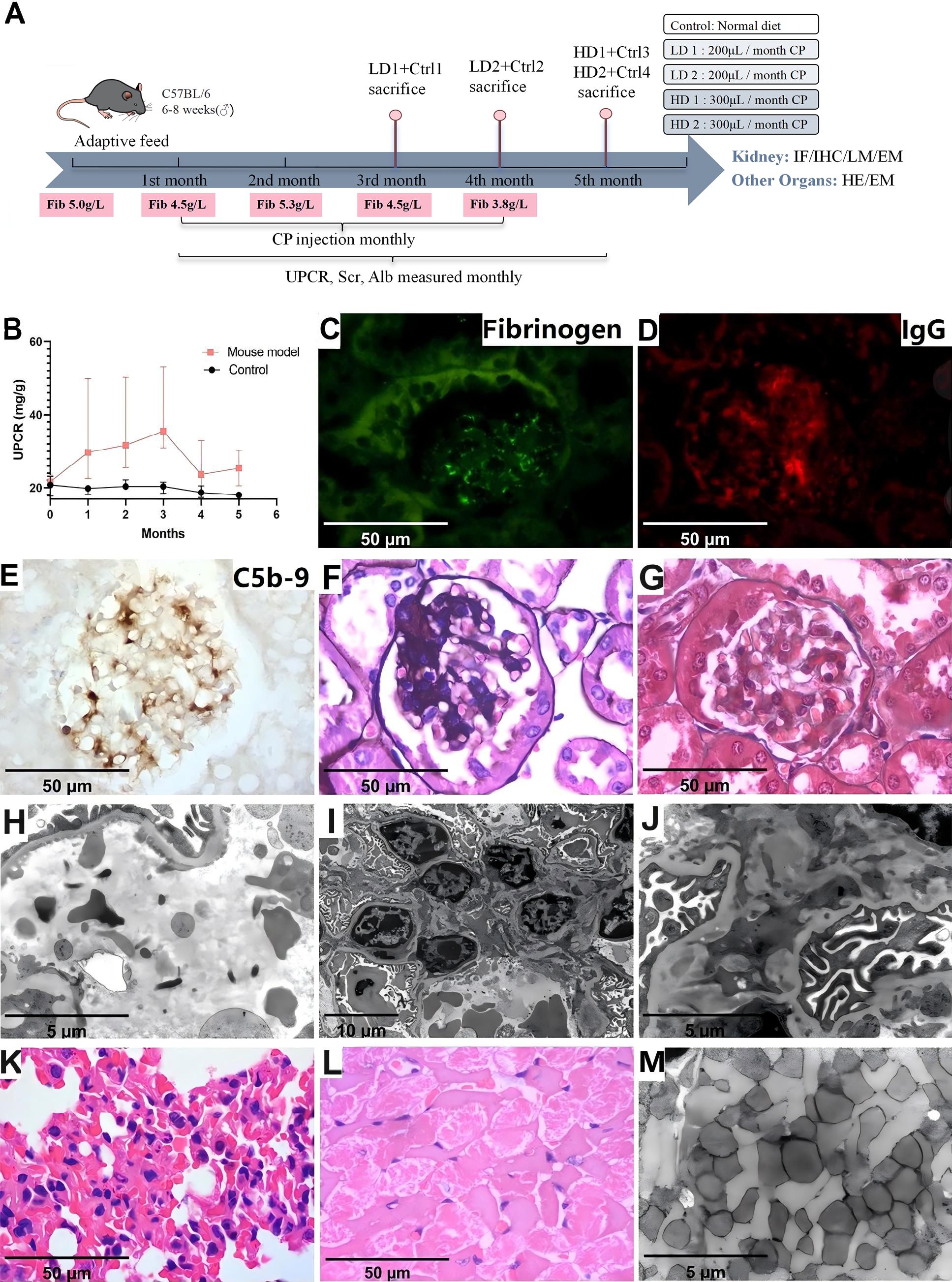 Diagram showing an experimental timeline (A) with adaptive feeding and CP injections for mice. A line graph (B) illustrates UPCR levels over six months for a mouse model and control. Immunofluorescence images (C, D, E) display kidney tissue staining for fibrinogen, IgG, and C5b-9. Histological images (F, G, K, L) show kidney tissue at various stages and staining techniques. Electron microscopy images (H, I, J, M) depict cellular ultrastructure and kidney tissue details at different magnifications. Each image includes scale bars for reference.