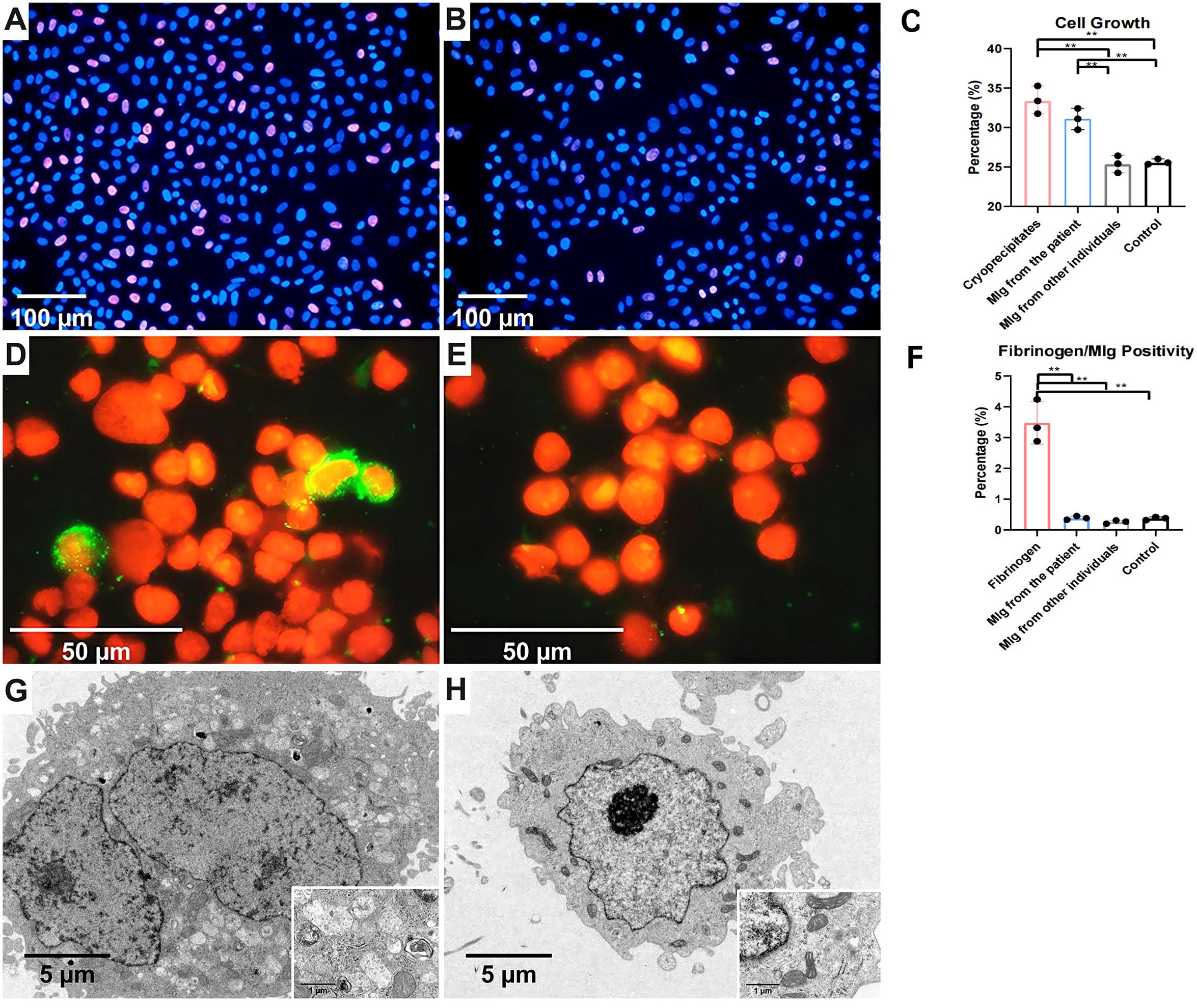 Images A and B show fluorescence microscopy of cells with blue nuclei and some pink staining under different conditions. Graph C depicts cell growth percentages across various treatments, indicating significant differences. Images D and E show stained cells in orange and green, highlighting specific cellular components. Graph F displays fibrinogen and M/Ig positivity, showing significant differences between groups. Images G and H are electron micrographs illustrating cell ultrastructure with detailed insets, offering a closer view of cellular components.