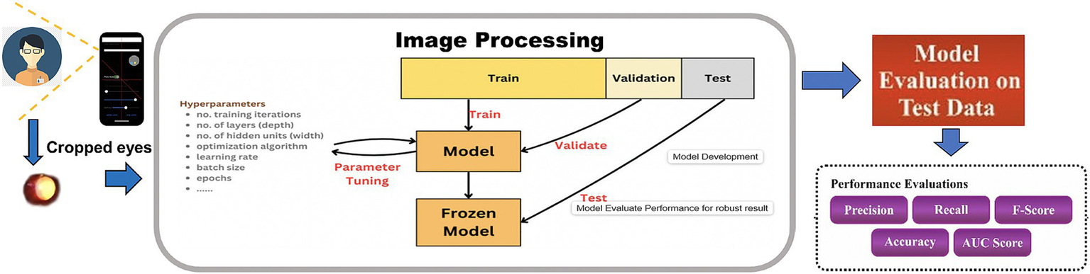 The flowchart illustrates the complete workflow of a deep learning system designed for classifying refractive errors. The process begins with a user capturing an eye image using a smartphone. This image then enters an "Image Processing" pipeline, which involves training, validating, and testing a deep learning model. During this phase, hyperparameters like training iterations and learning rate are tuned to optimize the model, leading to a "Frozen Model." Finally, the system undergoes "Model Evaluation on Test Data," where its performance is rigorously assessed using metrics such as precision, recall, F-score, accuracy, and AUC score.