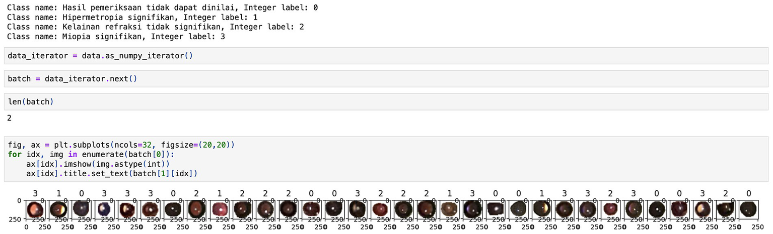 Output from code showing data classification and visualization of photorefractive images. At the top, it defines four class labels for refractive errors, mapped to integers 0 through 3, i.e., 0 for "not applicable to classify," 1 for "significant hypermetropia," 2 for "insignificant refractive error," and 3 for "significant myopia". Below, Python code uses a data iterator to process image batches. The bottom section shows a grid of 32 eye images, each labeled with its corresponding integer classification (0, 1, 2, or 3), visually representing the model's output for different refractive error categories.