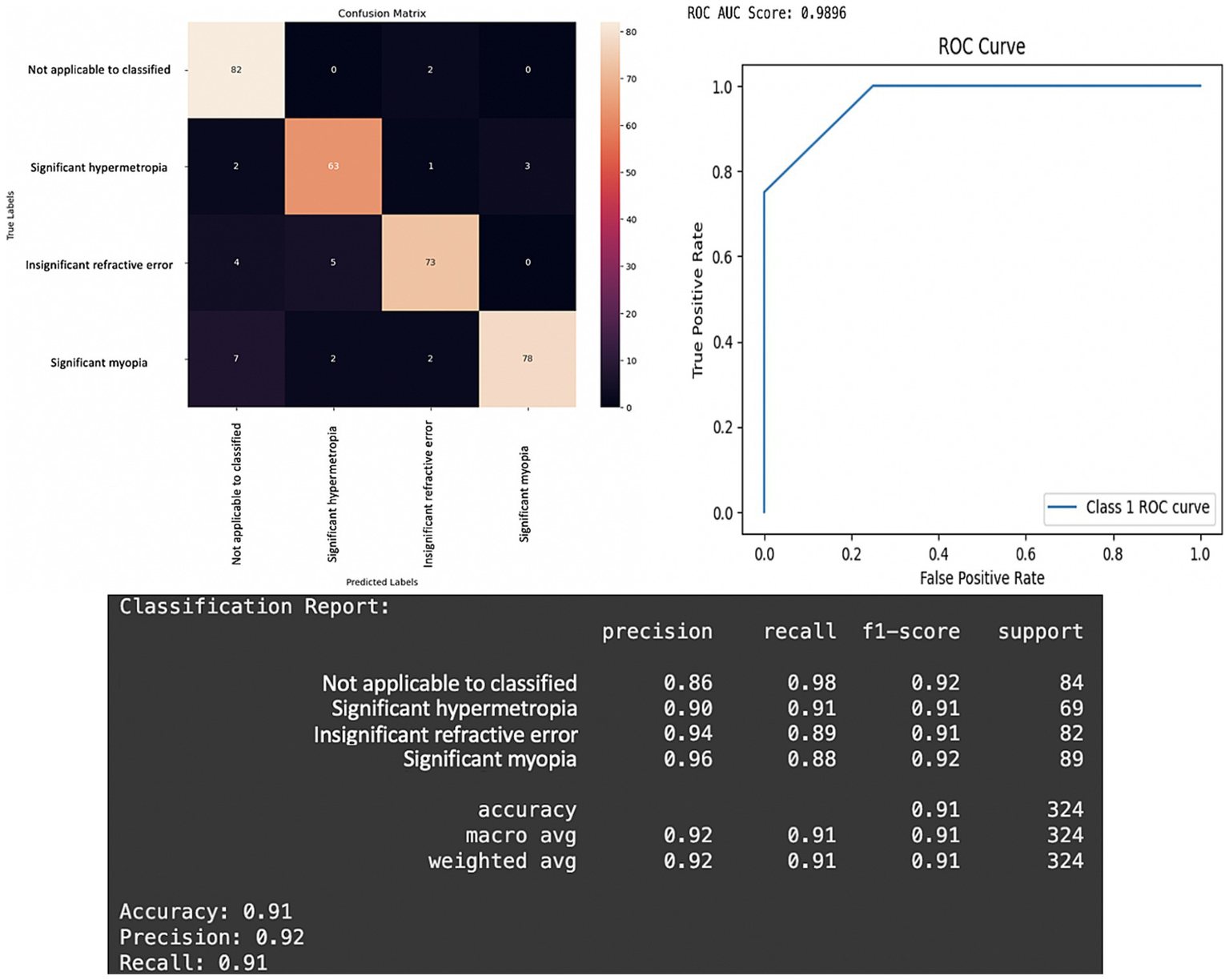 The performance evaluation of the refractive error classification model. A confusion matrix visually summarizes the model's predictive accuracy across four distinct categories: "not applicable to classify," "significant hypermetropia," "insignificant refractive error," and "significant myopia." The ROC (Receiver Operating Characteristic) curve is displayed with an impressive AUC (Area Under the Curve) score of 0.9896, clearly illustrating the model's strong diagnostic capability across various classification thresholds. A detailed classification report provides key metrics such as precision, recall, and F1-score for each individual category, alongside overall accuracy, precision, and recall, all consistently achieving a value of 0.91.