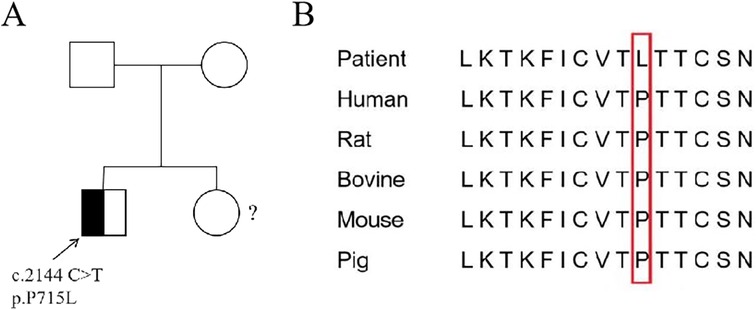 Pedigree chart and protein sequence comparison. Part A shows a family tree with one affected individual indicated by a half-filled square, with a mutation c.2144 C>T, p.P715L. Part B displays an alignment of protein sequences across different species. The patient has a variation from \