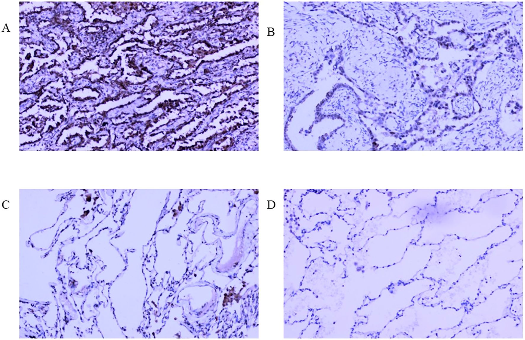 Microscopic images labeled A, B, C, and D show different patterns of tissue staining. A shows dense, dark staining with compact structures. B shows lighter staining with more dispersed, loose structures. C displays a mix of dense and loose staining with irregular shapes. D presents the lightest staining with a sparse distribution and open spaces.