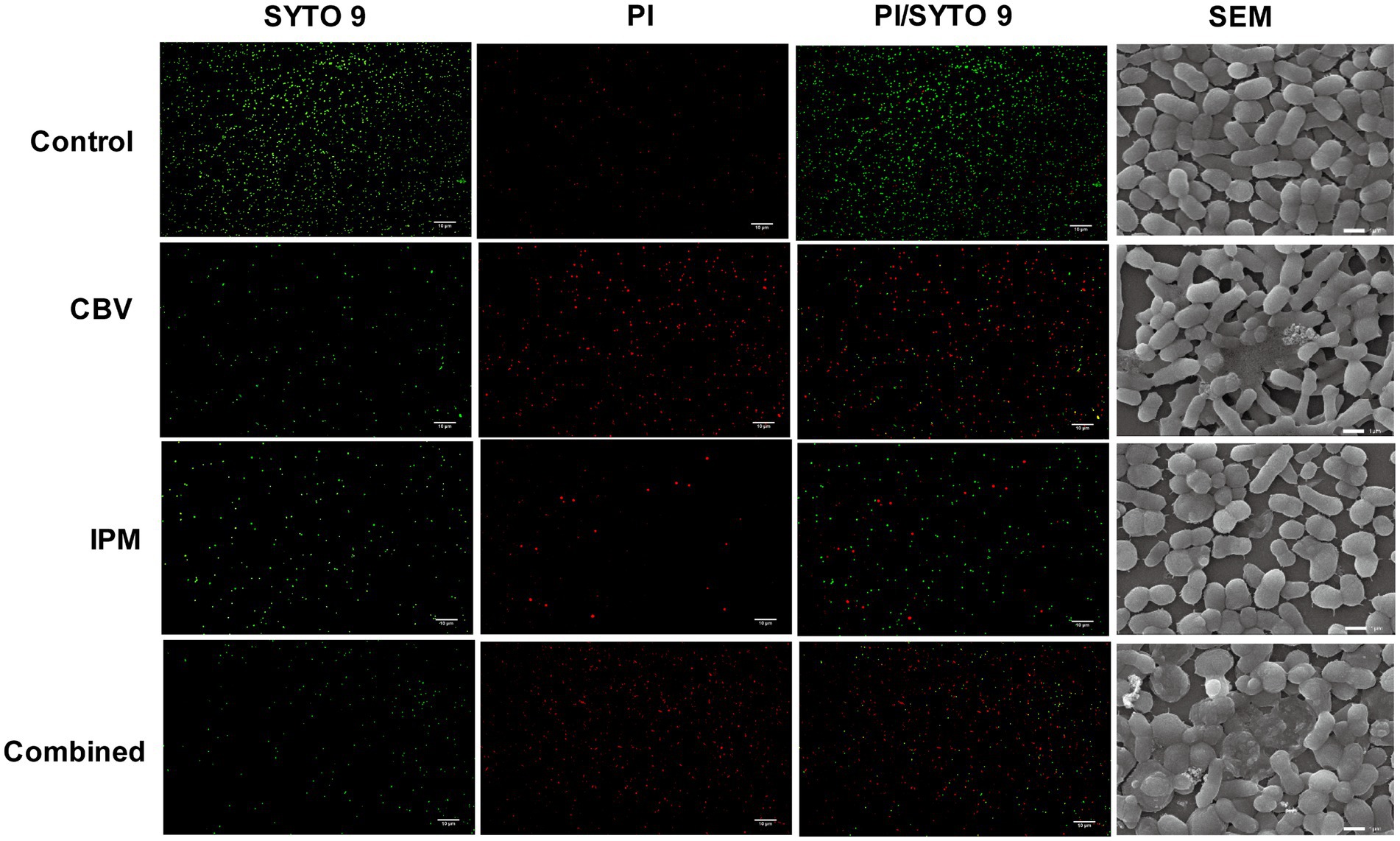 Set of microscopy images showing bacterial samples under four conditions: Control, CBV, IPM, and Combined. Each condition has four columns: SYTO 9 staining (green), PI staining (red), a merge of both stains, and SEM images. The images reveal variations in bacterial density and morphology across the different treatments.