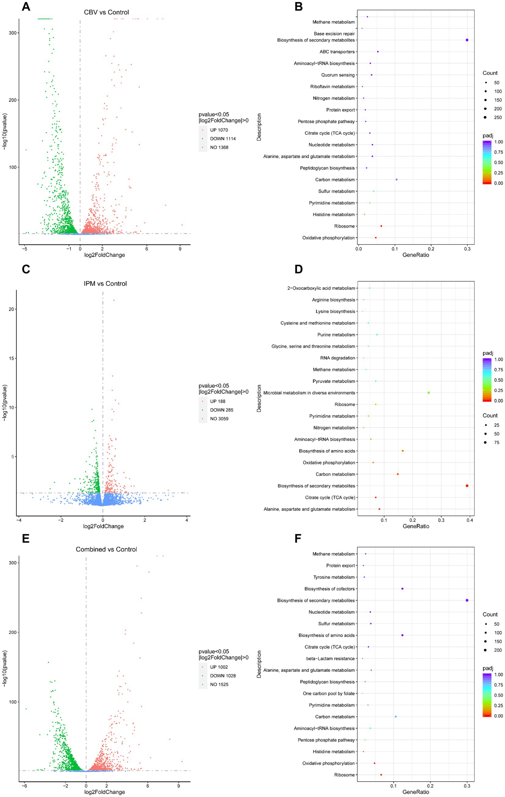 Panel A shows a volcano plot of CBV vs. Control with data points colored to indicate significance and change direction. Panel B features a dot plot indicating enriched pathways and their gene ratios. Panel C displays a volcano plot comparing IPM vs. Control, with a similar layout to panel A. Panel D shows a dot plot of enriched pathways for IPM. Panel E offers a combined volcano plot with overall gene expression differences. Panel F provides a dot plot for enriched pathways in the combined data, all panels displaying relevant pathological mechanisms.