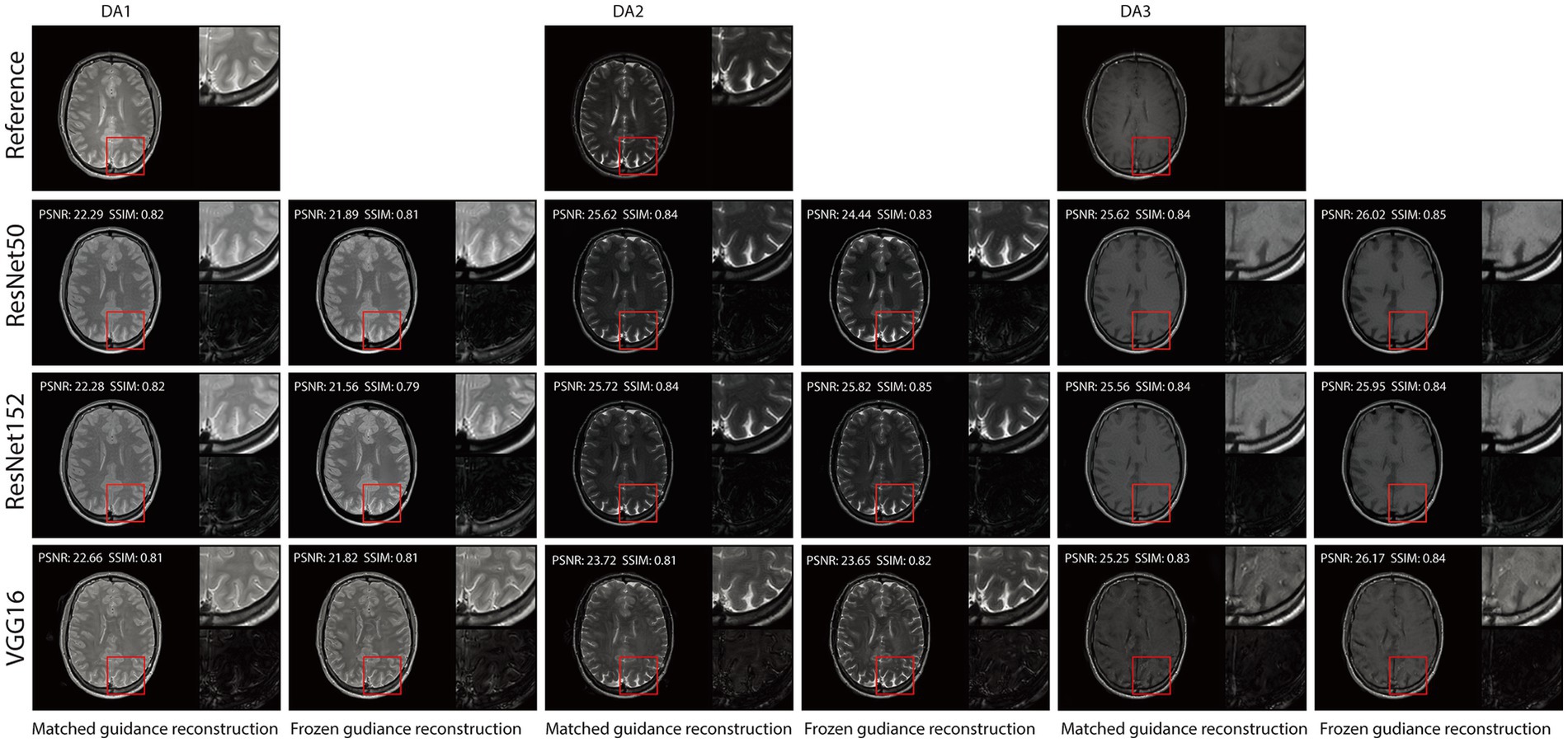 MRI reconstruction comparison across datasets DA1–DA3 using ResNet50, ResNet152, and VGG16 models under matched and frozen guidance modes. Each row shows the reconstructed image and a zoomed-in region (highlighted by a red box) alongside the PSNR and SSIM values. The top row displays the 3T reference images for ground truth. Deep learning models show high visual similarity and quantitative performance, with frozen guidance sometimes yielding finer structural details.