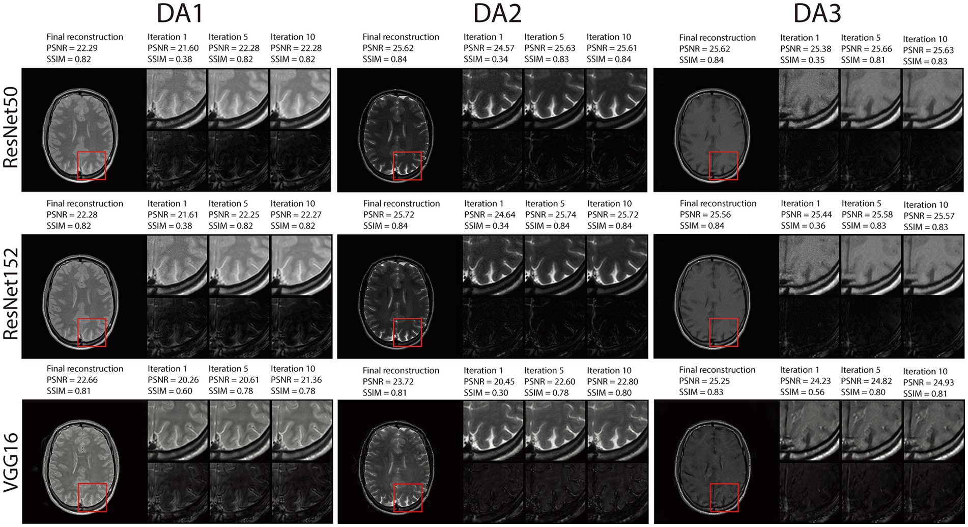 MRI reconstruction results over iterations for datasets DA1–DA3 using ResNet50, ResNet152, and VGG16. Each row shows the final reconstruction alongside iteration 1, 5, and 10 outputs with PSNR and SSIM values. Red boxes highlight zoomed regions to visualize detail improvements. All models show progressive enhancement in image quality over iterations, with ResNet-based models achieving higher PSNR/SSIM than VGG16.