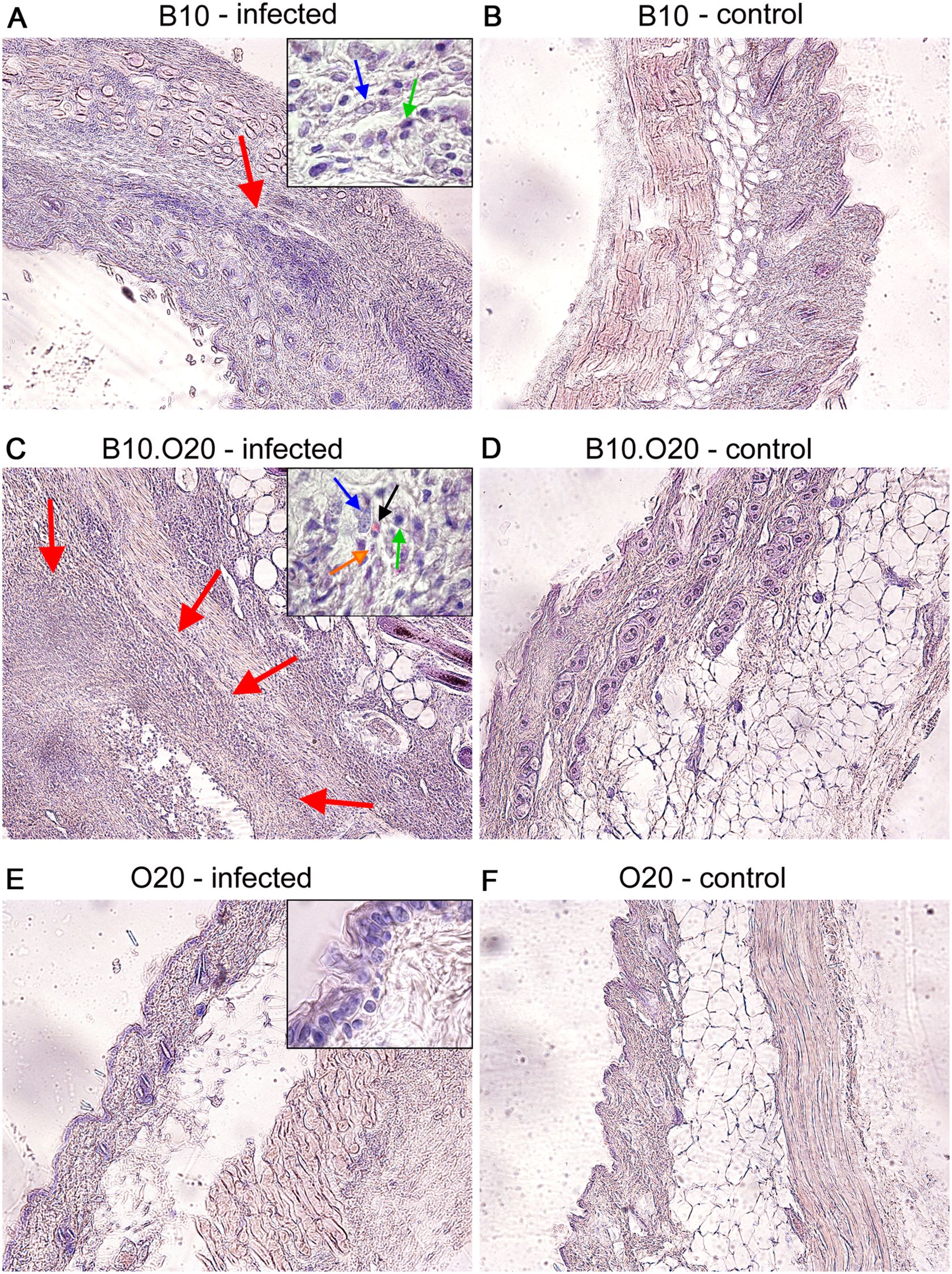 Histological images comparing infected and control tissue samples for B10, B10.O20, and O20 mouse strains. Panels A, C, and E show infected tissues with red arrows highlighting inflammation. Insets reveal close-ups with colored arrows indicating specific features. Panels B, D, and F show corresponding control tissues with no signs of infection.