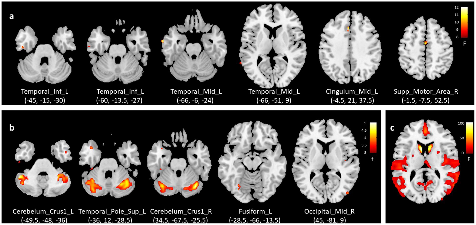 Brain MRI scans show different brain regions with highlighted areas representing activity. Panels a and b display slices with various labeled brain regions and coordinates, while panel c shows an overall view with a color scale indicating intensity in red and yellow.