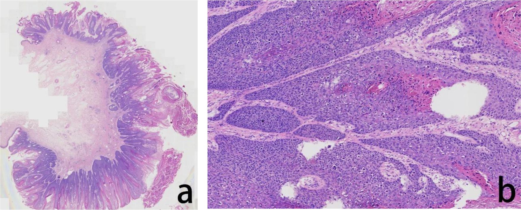 Panel a shows a histological section with folded tissue structures stained in purple and pink hues, indicative of cellular morphology. Panel b shows a close-up of dense cellular arrangements with visible nuclei, also stained purple and pink, revealing detailed tissue architecture.