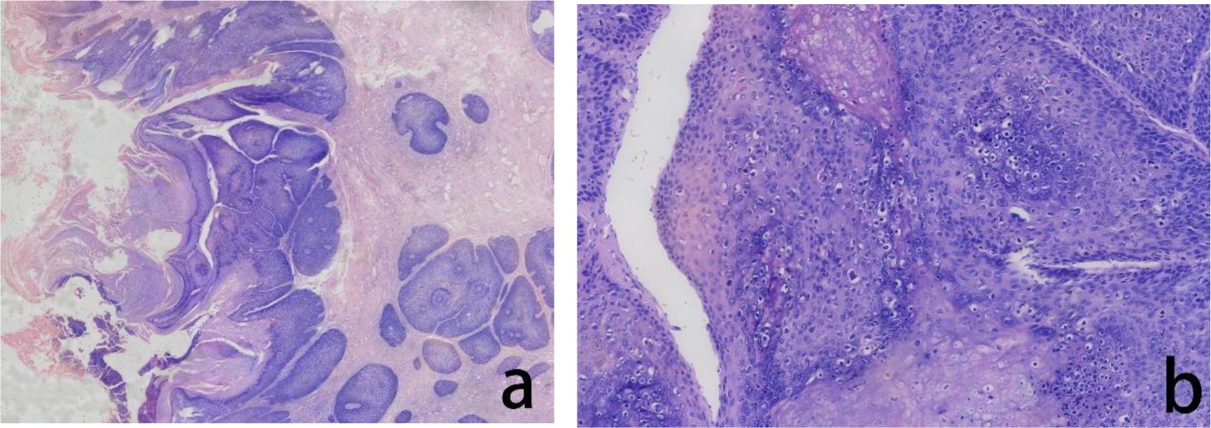 Histological slides showing tissue samples stained in shades of purple and pink. Image (a) highlights a cross-sectional view with various textures and large oval structures. Image (b) displays a closer view with densely packed cells and small nuclei. Both samples emphasize tissue morphology.