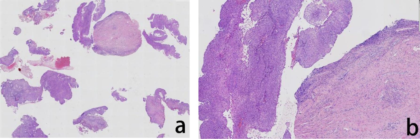 Histological images labeled a and b, showing tissue samples stained in shades of purple and pink. Image a displays fragmented tissue sections with varying densities. Image b shows a more continuous tissue structure with distinct cell patterns and textures.