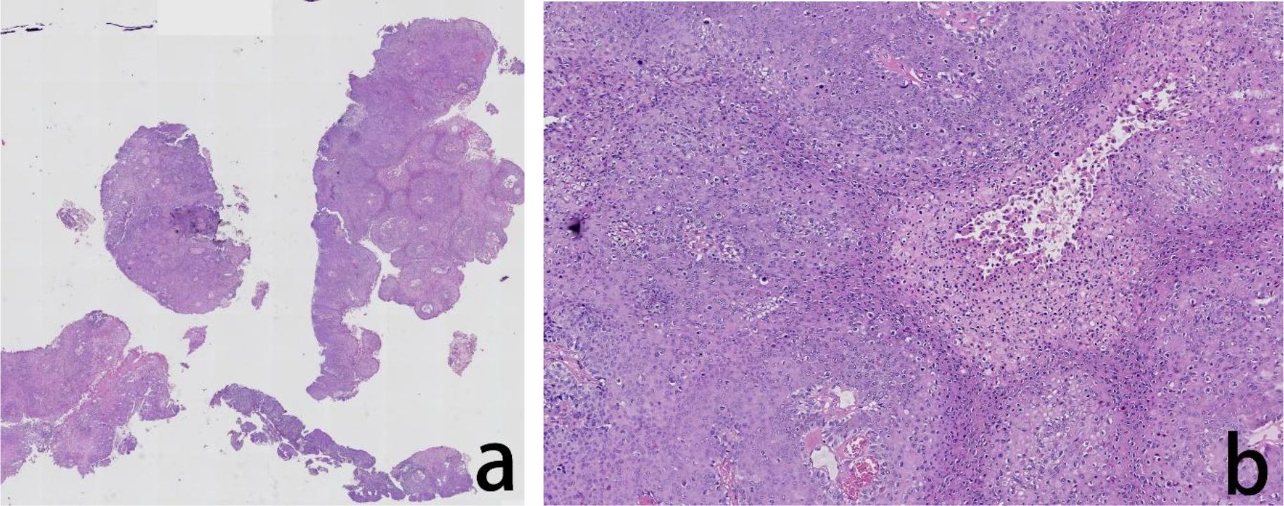 Histological slides showing tissue samples stained with hematoxylin and eosin. Panel “a” depicts large clusters of cells with different structures and densities. Panel “b” provides a closer view of cells, revealing intricate cellular details and a dense arrangement.