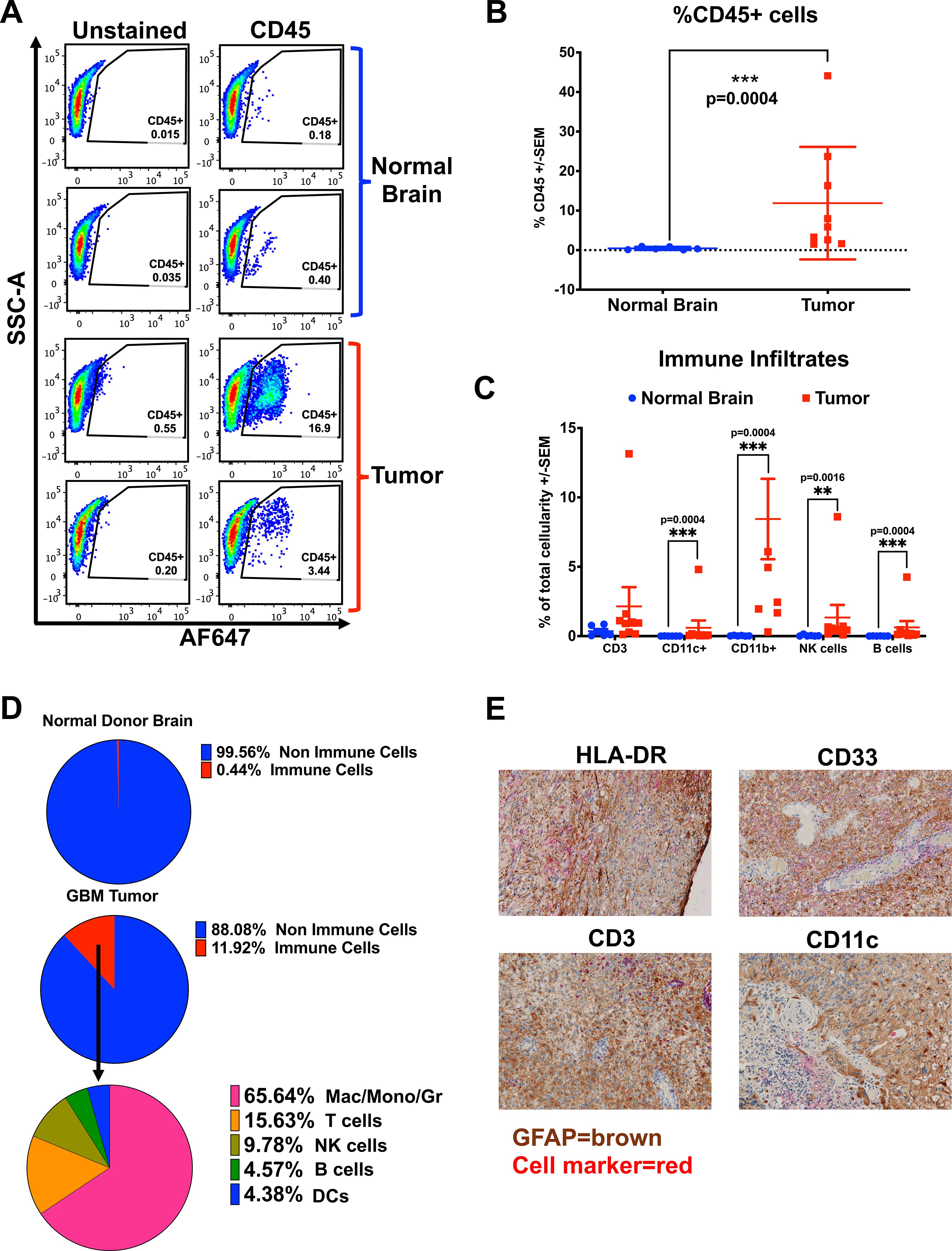 Panel of images and charts analyzing immune cell presence in normal brain versus tumor tissue. (A) Representative plots comparing CD45 expression in normal and tumor tissues. (B) Bar graph showing a significantly higher percentage of CD45+ cells in tumors compared to normal brain. (C) Bar graph detailing immune cell infiltrates, indicating significant differences in immune cell types between normal and tumor tissues. (D) Pie charts illustrating proportions of immune versus non-immune cells in normal and tumor tissues, broken down further into specific immune cell types in tumors. (E) Immunohistochemistry images showing expression of HLA-DR, CD33, CD3, and CD11c, with GFAP in brown and cell markers in red.