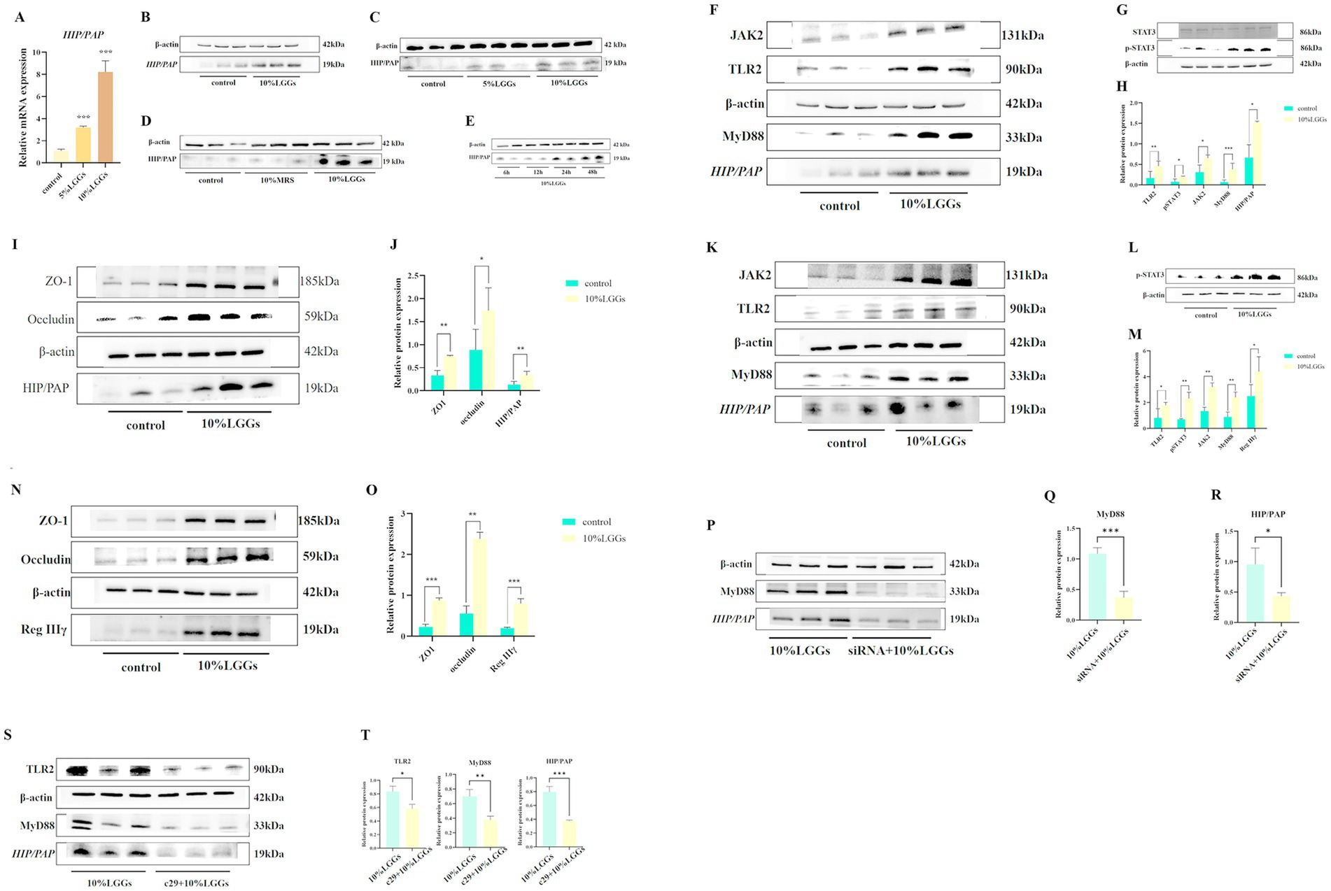 A scientific figure displays various Western blot analyses and corresponding bar graphs. Panels A to R illustrate the expression levels of different proteins such as HIP/PAP, β-actin, JAK2, TLR2, MyD88, ZO-1, and occludin under different conditions like control, 5% LGGs, and 10% LGGs. The blots show changes in protein levels, while the bar graphs quantify these changes statistically with indicators of significance. Each panel is labeled with letters for reference.