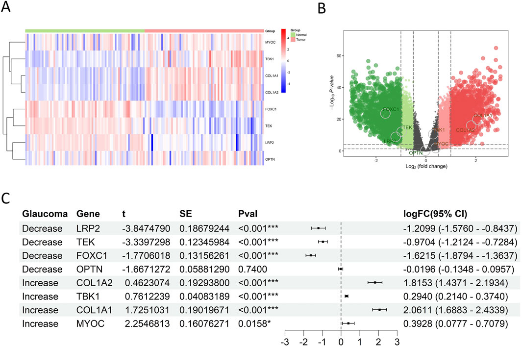 Panel A shows a heatmap of gene expression with grouped sample data, where red indicates higher expression and blue indicates lower expression. Panel B presents a volcano plot illustrating log fold changes versus negative log p-values for genes in glaucoma research, highlighting significant genes. Panel C is a table listing genes associated with glaucoma, detailing statistical values such as t-statistics, standard error, p-values, and log fold change with confidence intervals.
