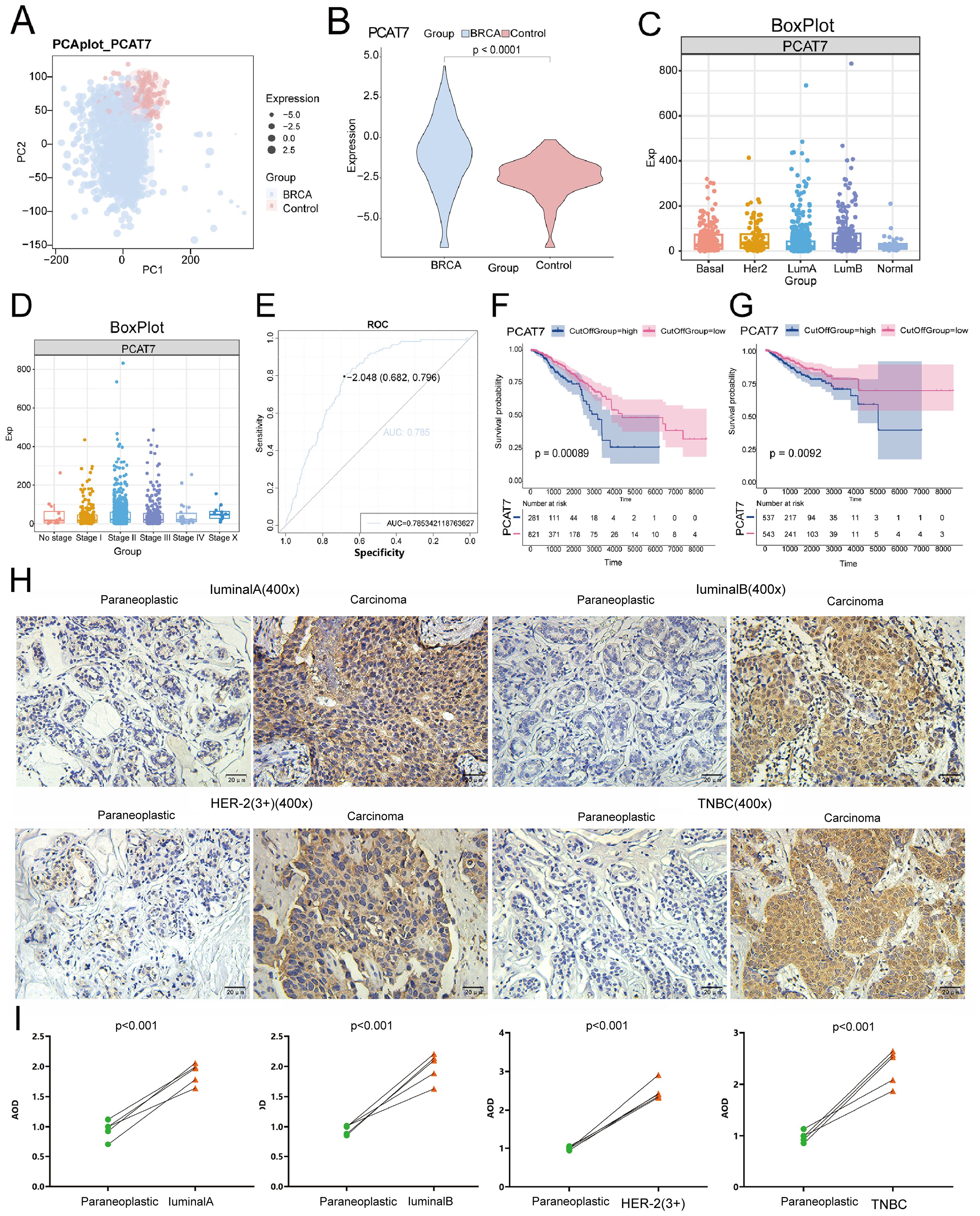 The image consists of several panels depicting various data visualizations and microscopic images related to PCAT7 expression in breast cancer research. Panel A presents a PCA plot, showing two groups: BRCA and control. Panel B includes a violin plot comparing PCAT7 expression levels in these groups. Panels C and D provide box plots categorizing expression by cancer stages and subtypes. Panel E displays an ROC curve evaluating diagnostic performance. Panels F and G show survival curves for high and low PCAT7 expression groups. Panel H features microscopic images at 400x magnification comparing para-neoplastic and different carcinoma types. Panel I shows line graphs illustrating PCAT7 expression differences across various groups, with statistical significance denoted.
