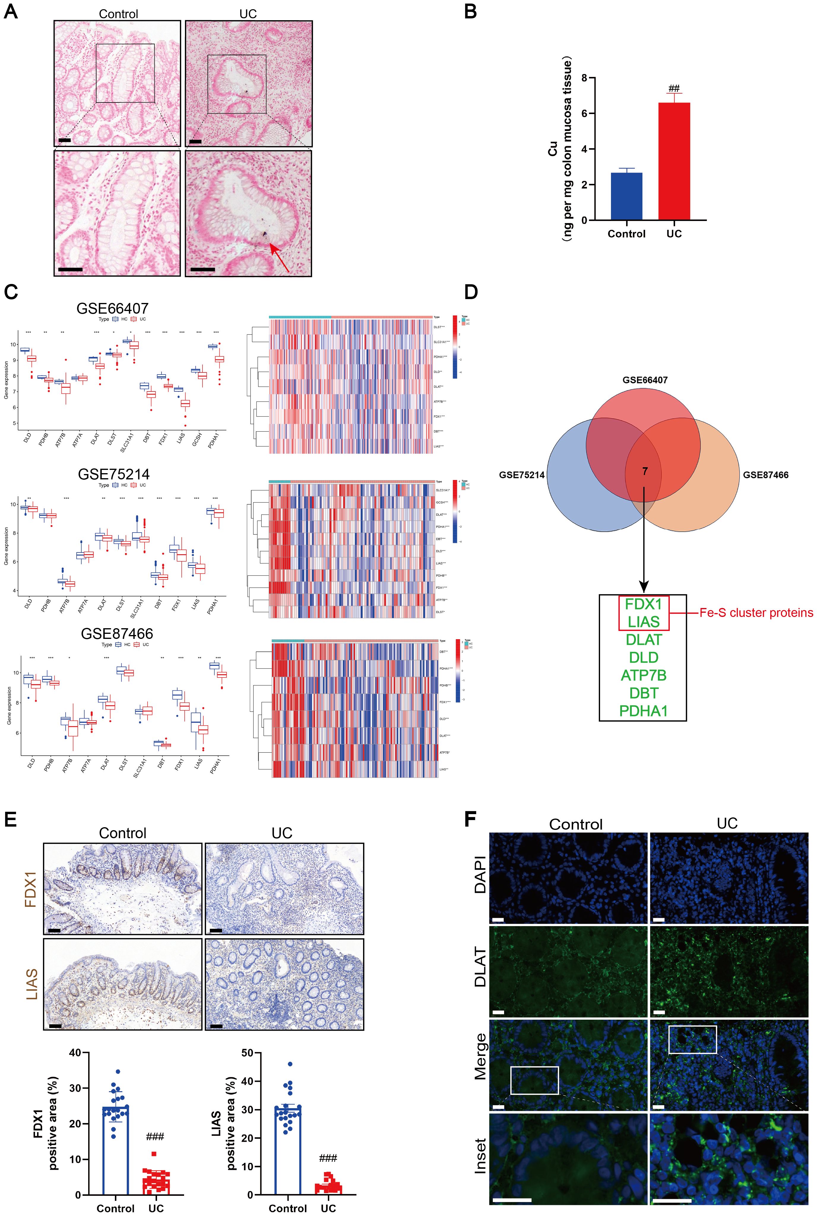 A composite image with six sections labeled A to F. A: Microscopic images showing colon tissue from control and ulcerative colitis (UC) samples, highlighting differences in tissue structure with red arrows indicating specific areas. B: Bar graph comparing copper levels in colon mucosa tissue between control and UC samples, indicating higher levels in UC. C: Box plots and heatmaps for three datasets (GSE66407, GSE75214, GSE87466), showing gene expression differences between control and UC groups. D: Venn diagram of datasets identifying seven common genes related to Fe-S cluster proteins. E: Immunohistochemistry images and bar graphs for FDX1 and LIAS proteins, showing reduced expression in UC samples. F: Fluorescence images showing DAPI and DLAT expression in control and UC tissues, with merged images highlighting expression differences.