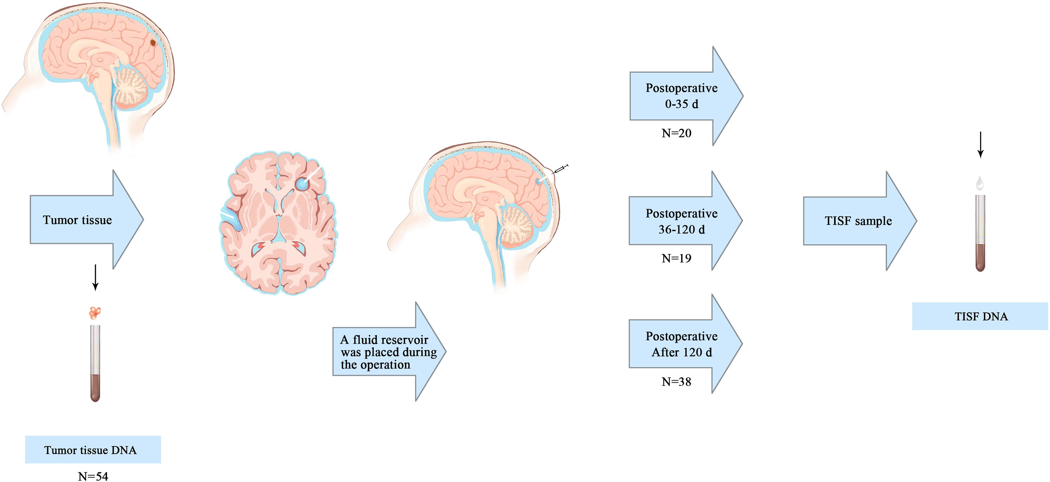Diagram showing the collection of tumor tissue and TISF samples from the brain. Tumor tissue is collected and analyzed for DNA in 54 cases. A fluid reservoir is placed during surgery, and TISF samples are collected postoperatively at various intervals: 0-35 days (20 samples), 36-120 days (19 samples), and after 120 days (38 samples), for DNA analysis.