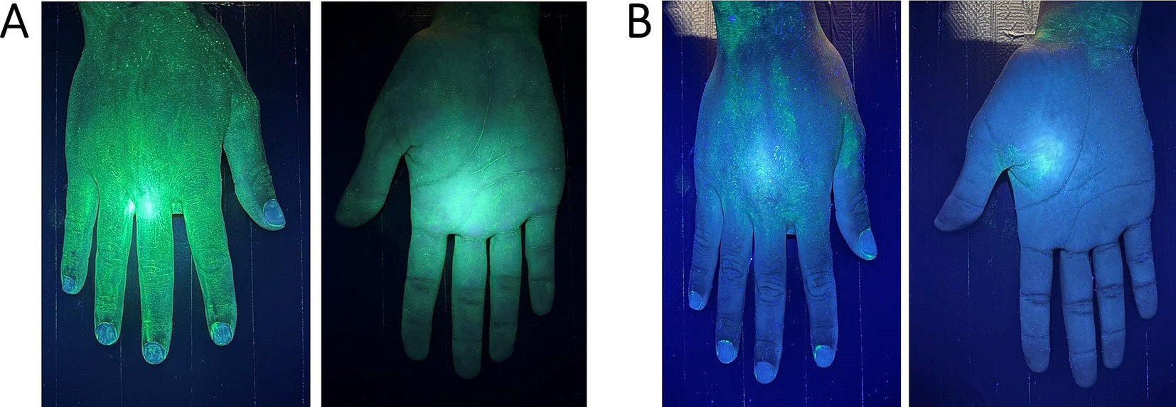 Two sets of hands under UV light labeled A and B. Both sets show hands with visible fluorescent markings, likely germs or bacteria, appearing as bright patches on the skin. The image highlights differences in luminescence patterns between the two hands.