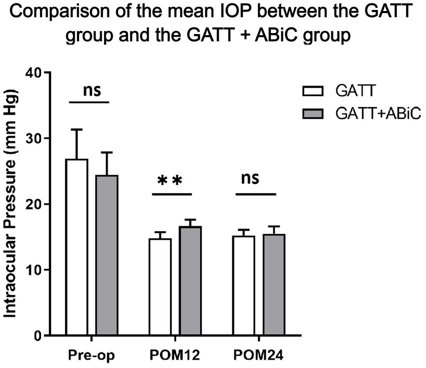 Bar graph comparing mean intraocular pressure (IOP) between GATT and GATT+ABiC groups at pre-op, POM12, and POM24 time points. Pre-op shows no significant difference. At POM12, GATT group shows a statistically significant lower IOP compared to GATT+ABiC. At POM24, the difference is not significant. Error bars show standard error to the 95% CIs. Preop, preoperative; POM, postoperative month; IOP, intraocular pressure; GATT, gonioscopy-assisted transluminal trabeculotomy; ABiC, ab interno canaloplasty.