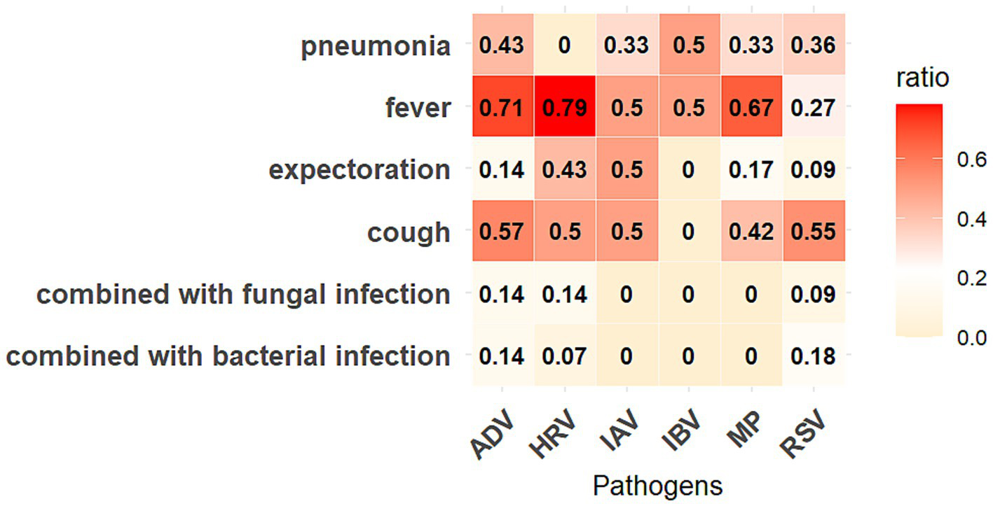 Heatmap showing the ratio of symptoms and infections across different pathogens (ADV, HRV, IAV, IBV, MP, RSV). The symptoms include pneumonia, fever, expectoration, cough, combined with fungal and bacterial infections. The color intensity ranges from light to dark red, representing ratios from 0.0 to 0.6. Fever has the highest ratio of 0.79 for HRV.