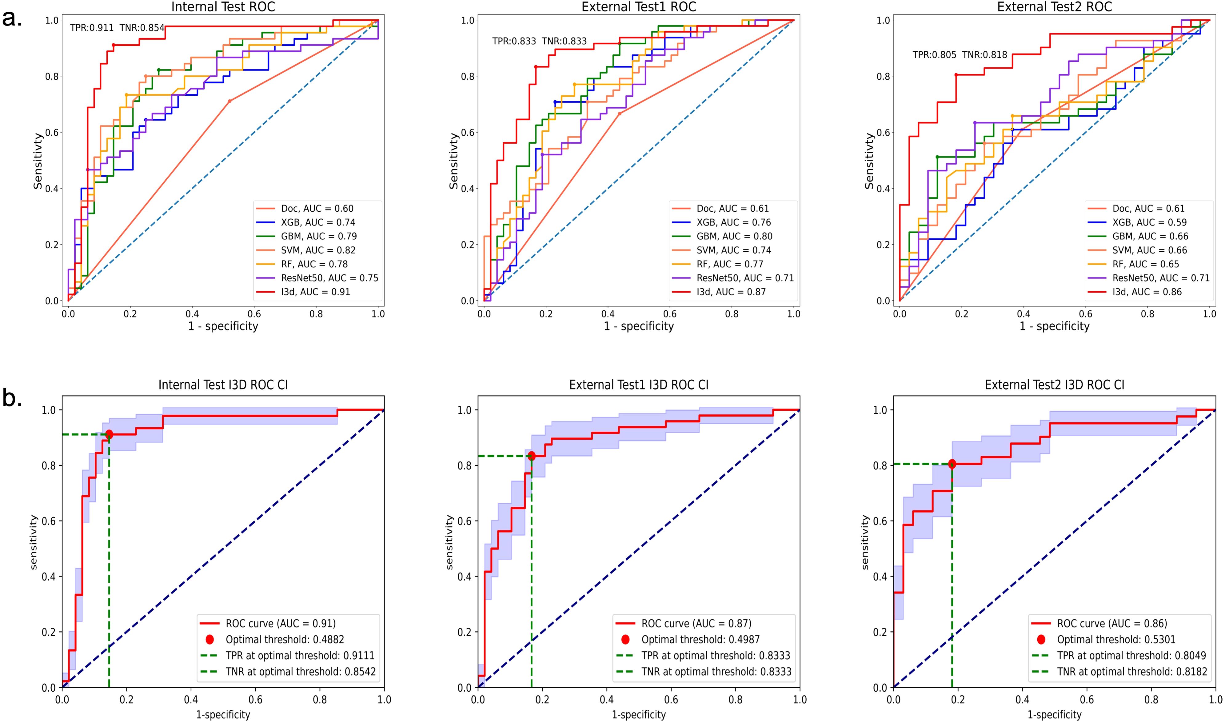 Three charts labeled “Internal Test ROC”, “External Test1 ROC”, and “External Test2 ROC” display Receiver Operating Characteristic (ROC) curves with different colored lines representing models: Doc, XGB, GBM, SVM, RF, ResNet50, and I3D, with their respective AUC values. Below, two ROC CI plots for “Internal Test I3D” and “External Test1 I3D” include AUC, optimal thresholds, and True Positive and True Negative Rates.