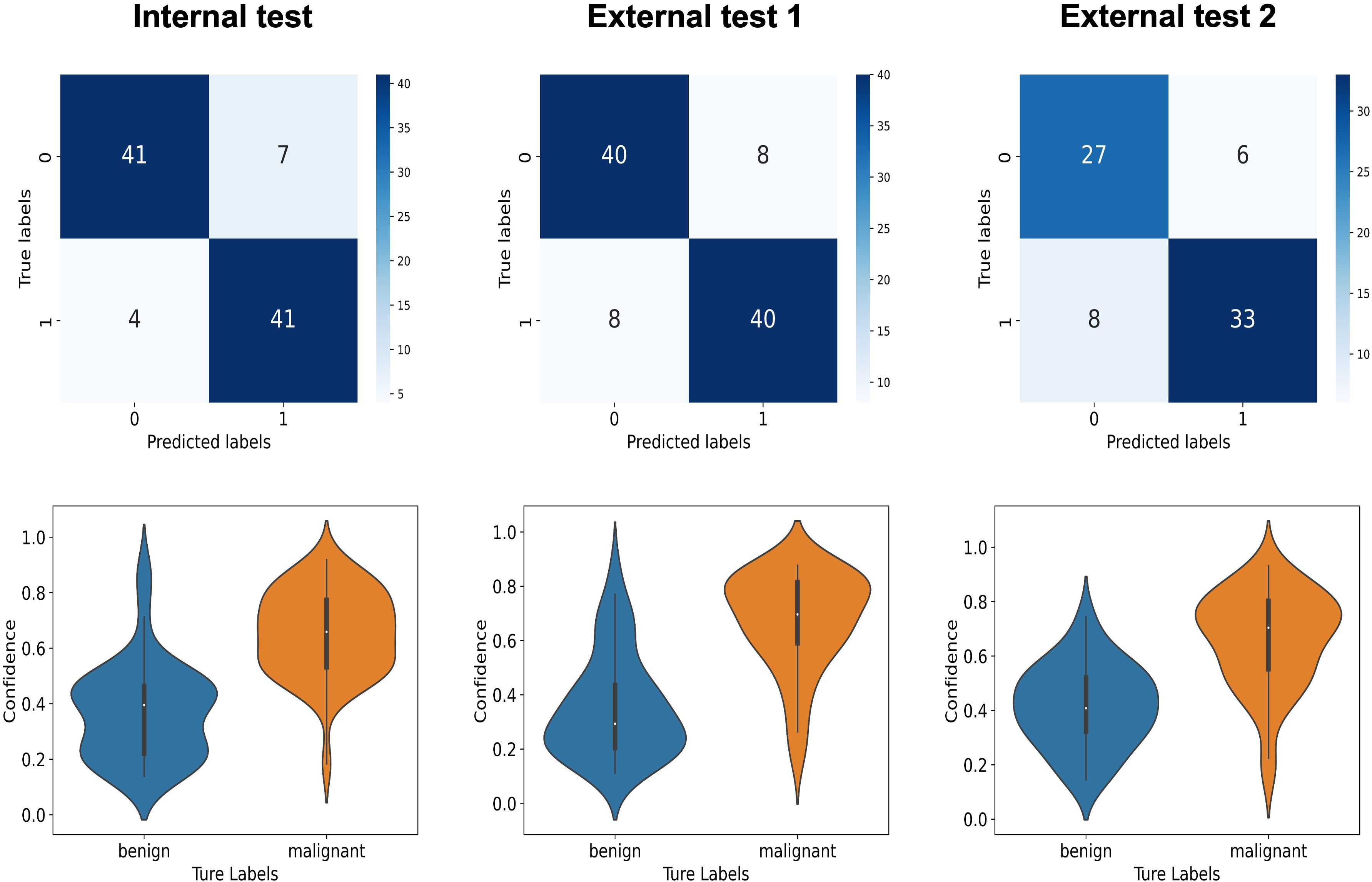 Three sets of confusion matrices and violin plots are displayed for internal and external tests. Each confusion matrix shows true versus predicted labels with counts: Internal test (41, 7, 4, 41), External test 1 (40, 8, 8, 40), and External test 2 (27, 6, 8, 33). Below each matrix, violin plots depict confidence distributions for benign and malignant labels, with distinct shapes and distributions for each test.