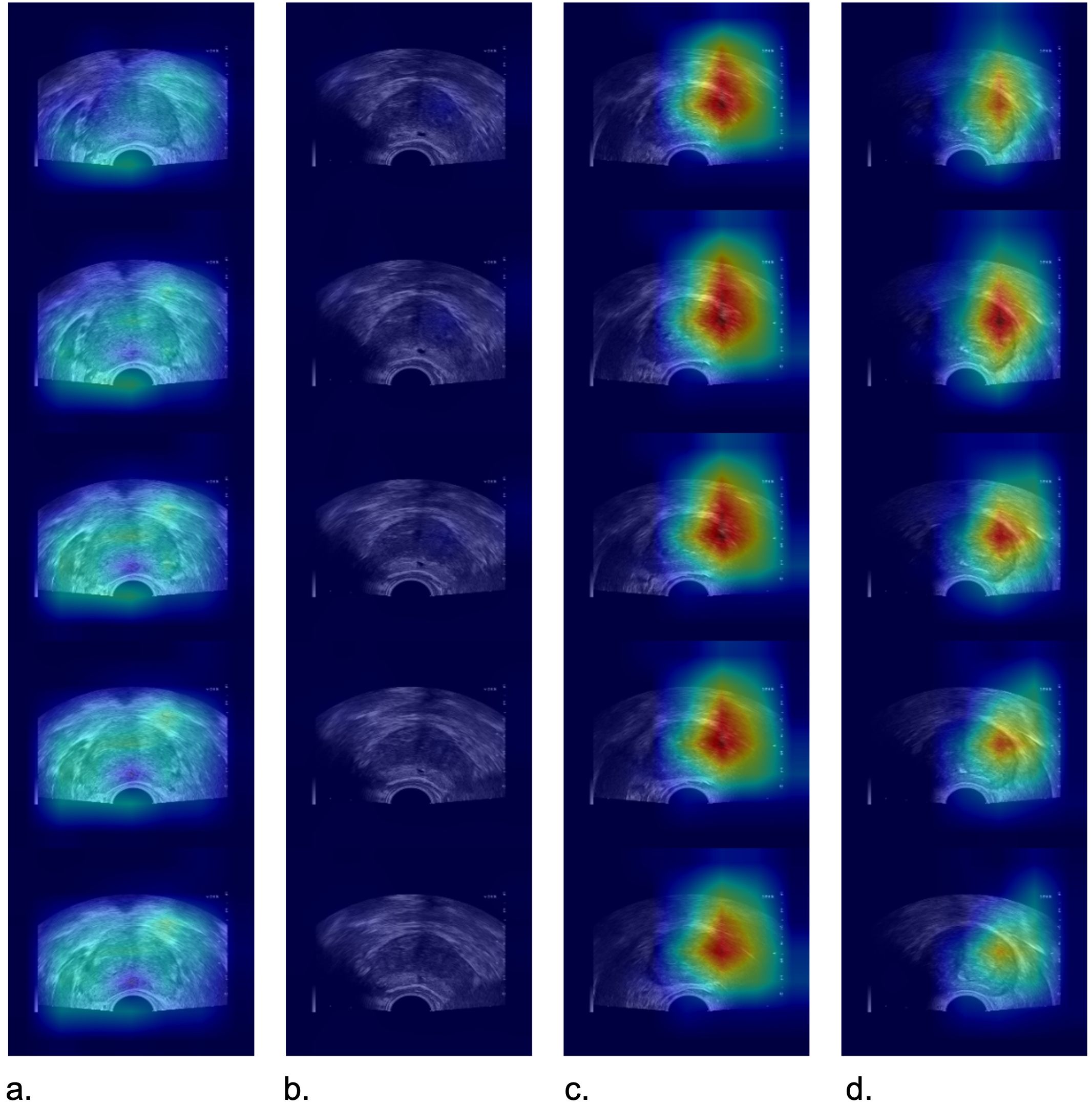 Four columns of medical imaging scans are shown, labeled a, b, c, and d. Column a displays colored ultrasound scans with green and blue hues. Column b features grayscale ultrasound scans without additional coloring. Column c presents ultrasound scans with a heatmap overlay showing areas of red and yellow. Column d also displays heatmap overlays with brighter color variations. Each column contains several vertically aligned scans highlighting different imaging techniques and color mappings.