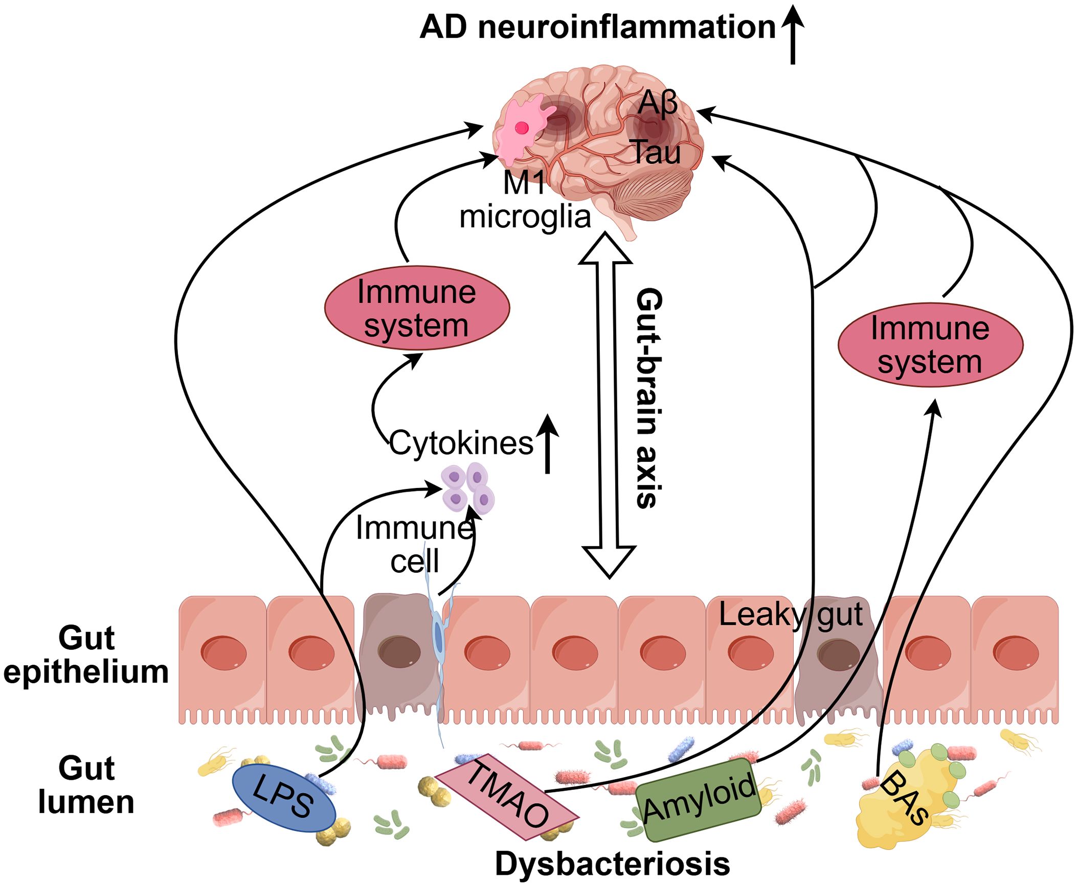 Diagram illustrating the gut-brain axis related to neuroinflammation in Alzheimer's disease. The pathway includes interactions between gut dysbiosis, leaky gut, immune cells, and the brain, highlighting key components like amyloid-beta, tau, cytokines, LPS, TMAO, and the immune system.
