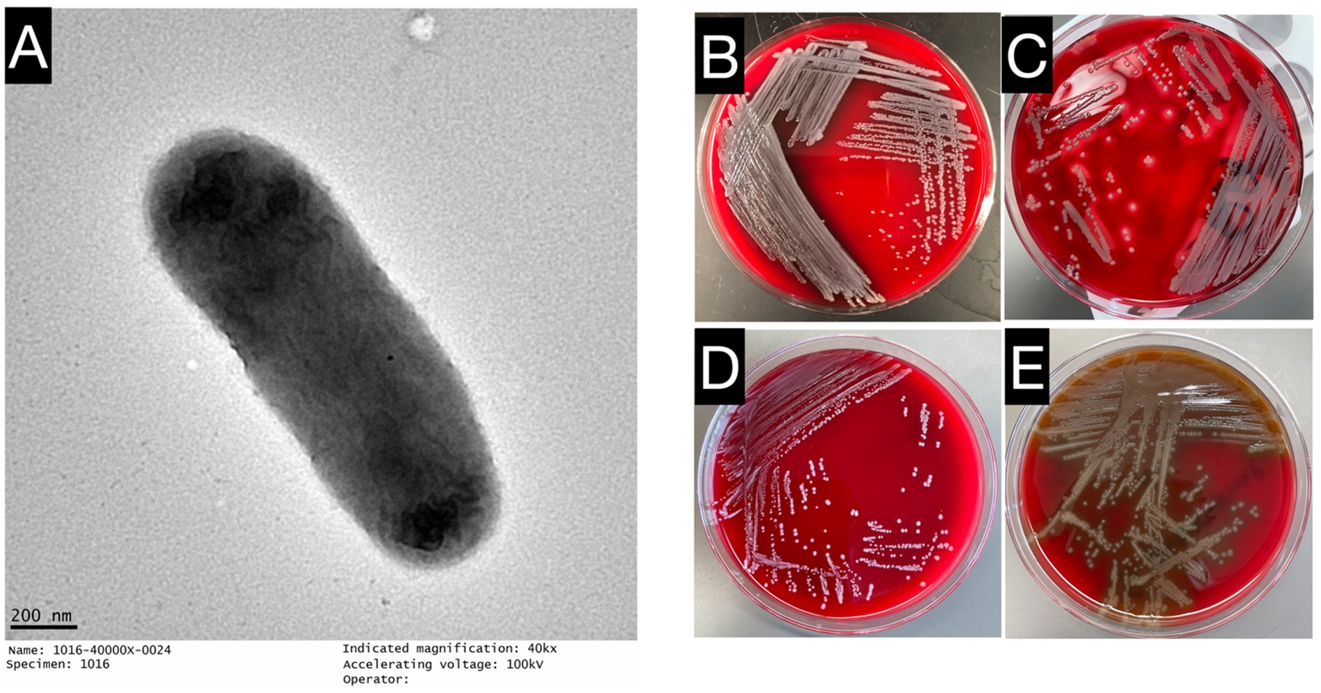 Panel A shows a grayscale electron micrograph of an elongated bacterium. Panels B, C, D, and E depict red agar plates with bacterial growth streak patterns. Panel E’s plate has a different coloration, indicating potential different bacterial properties.
