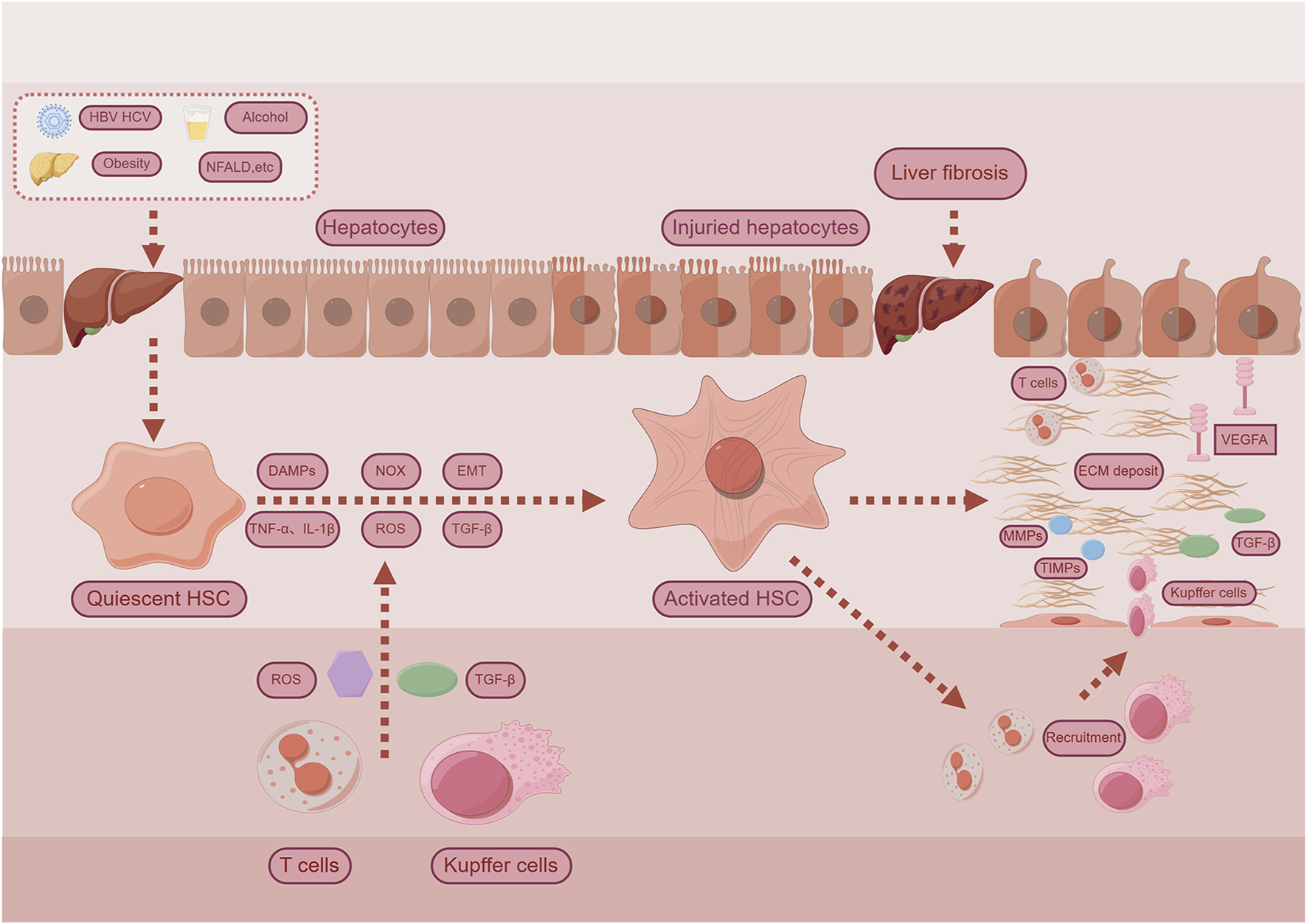 Illustration depicting the process of liver fibrosis. Hepatocytes are shown transitioning into injured hepatocytes and leading to liver fibrosis. Factors such as HBV, HCV, alcohol, and obesity affect this process. Quiescent hepatic stellate cells (HSC) become activated, influenced by several molecules like DAMPs, TNF-α, and TGF-β. The activation leads to ECM deposit, recruitment of T cells, Kupffer cells, and other molecules like MMPs, TIMPs, and VEGFA, contributing to liver fibrosis progression.