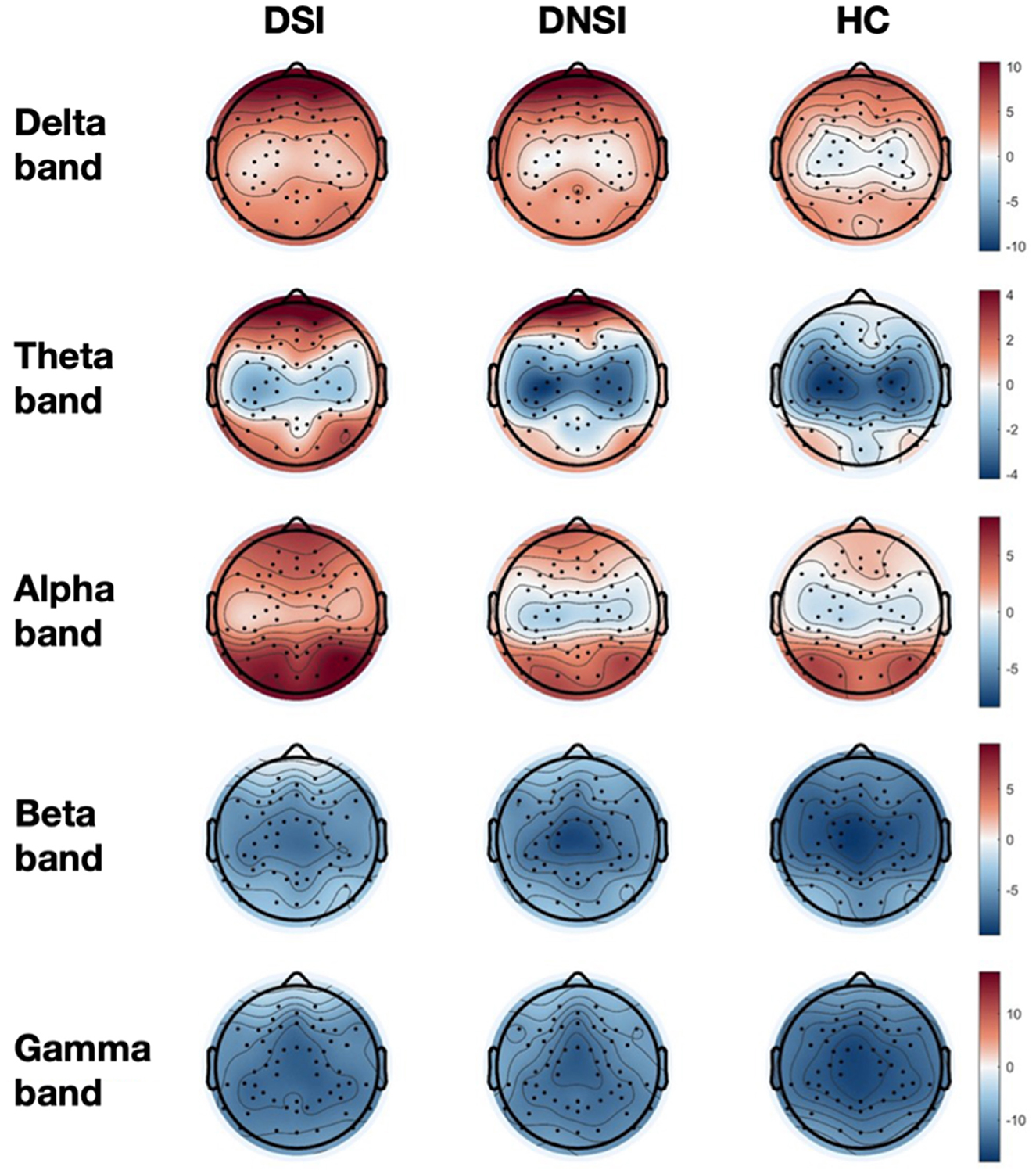 Scalp maps showing brain activity across five frequency bands: delta, theta, alpha, beta, and gamma for three groups: DSI, DNSI, and HC. Each map uses a color scale from blue to red, representing different activity levels.