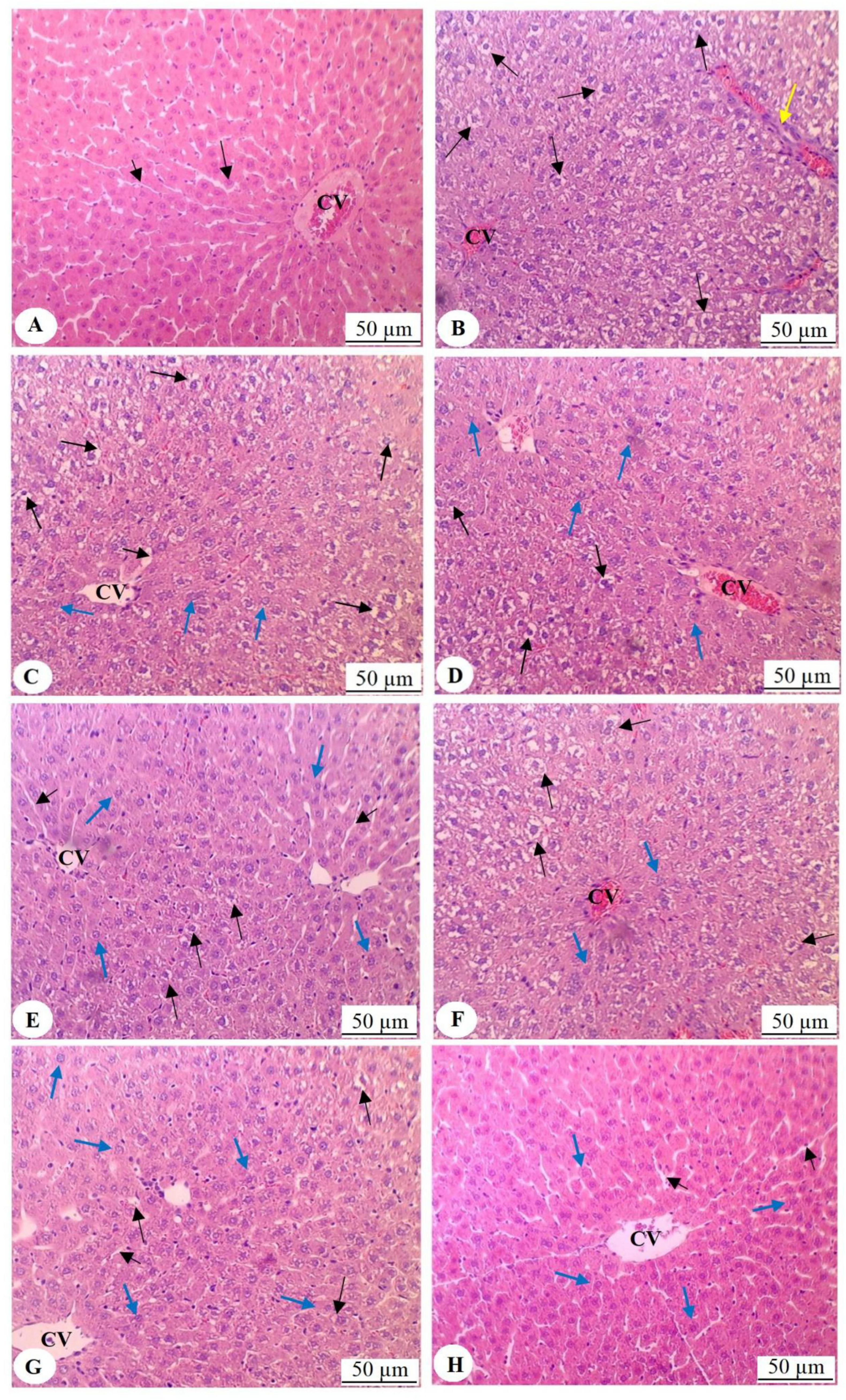 Histological images of liver tissue displayed in eight panels (A-H). Central veins (CV) are labeled in each panel. Arrows likely indicate different cellular or structural features, with varying colors suggesting different elements. Each image is magnified at fifty micrometers.